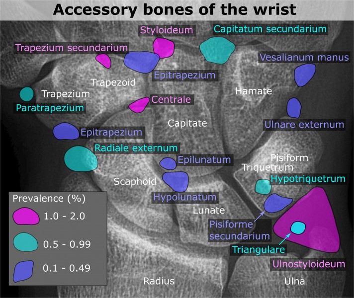 Accessory bones of the wrist