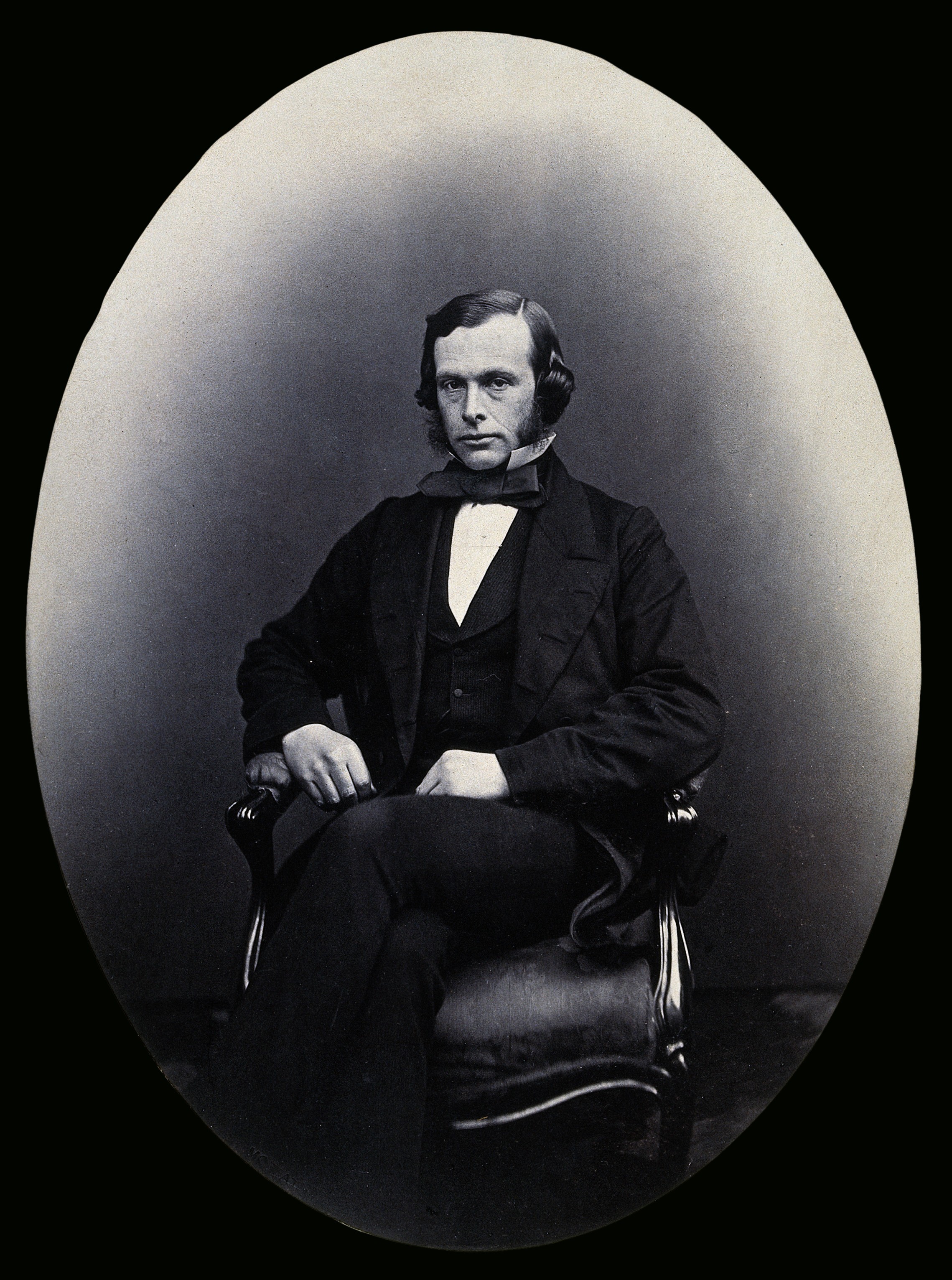 Joseph Lister, 1st Baron Lister (1827 – 1912) surgeon Wellcome V0027873