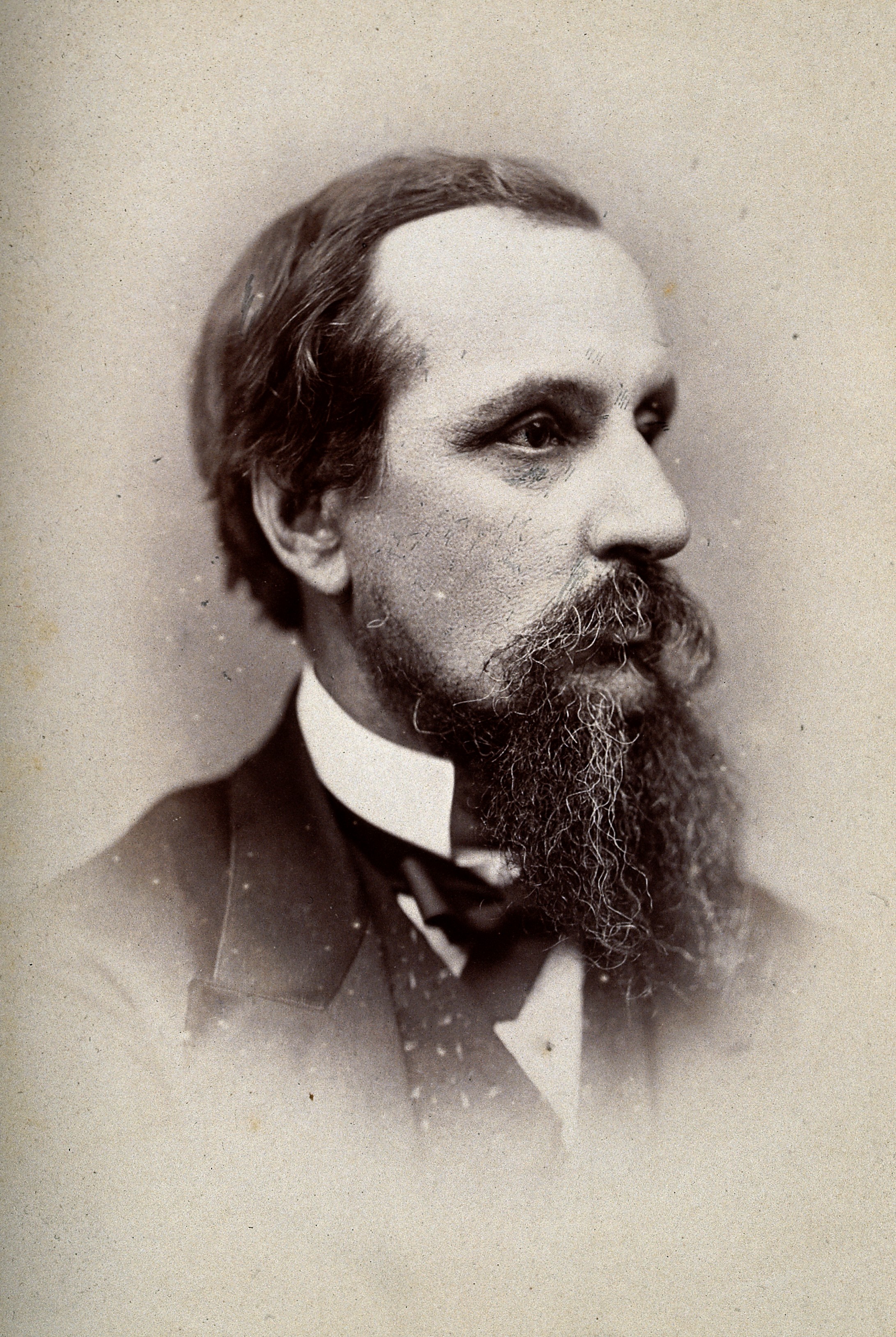 Sir Jonathan Hutchinson. Photograph by G. Jerrard, 1881. Wellcome V0026593