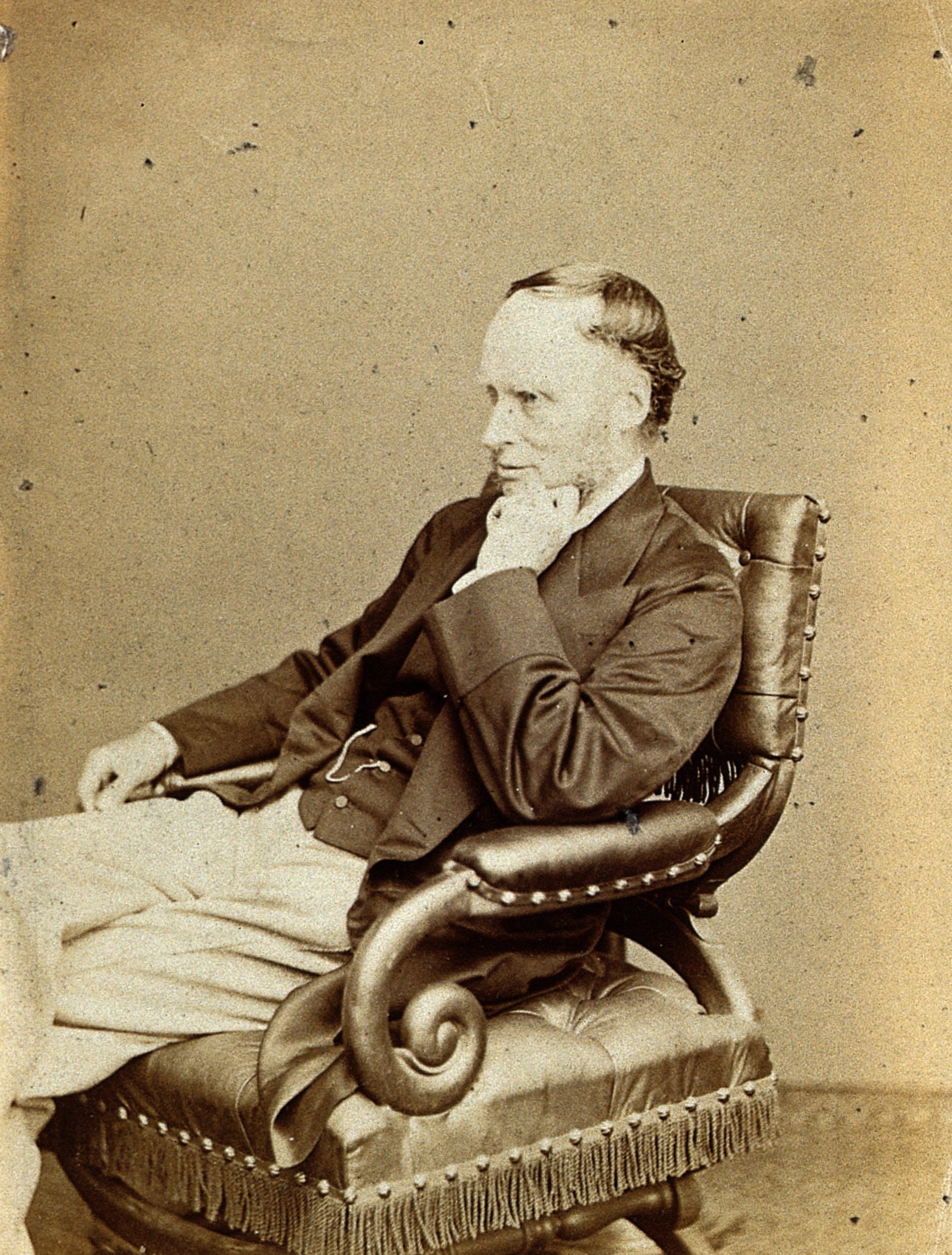 Thomas Pridgin Teale. Photograph by Ernest Edwards, 1867. Wellcome V0028417