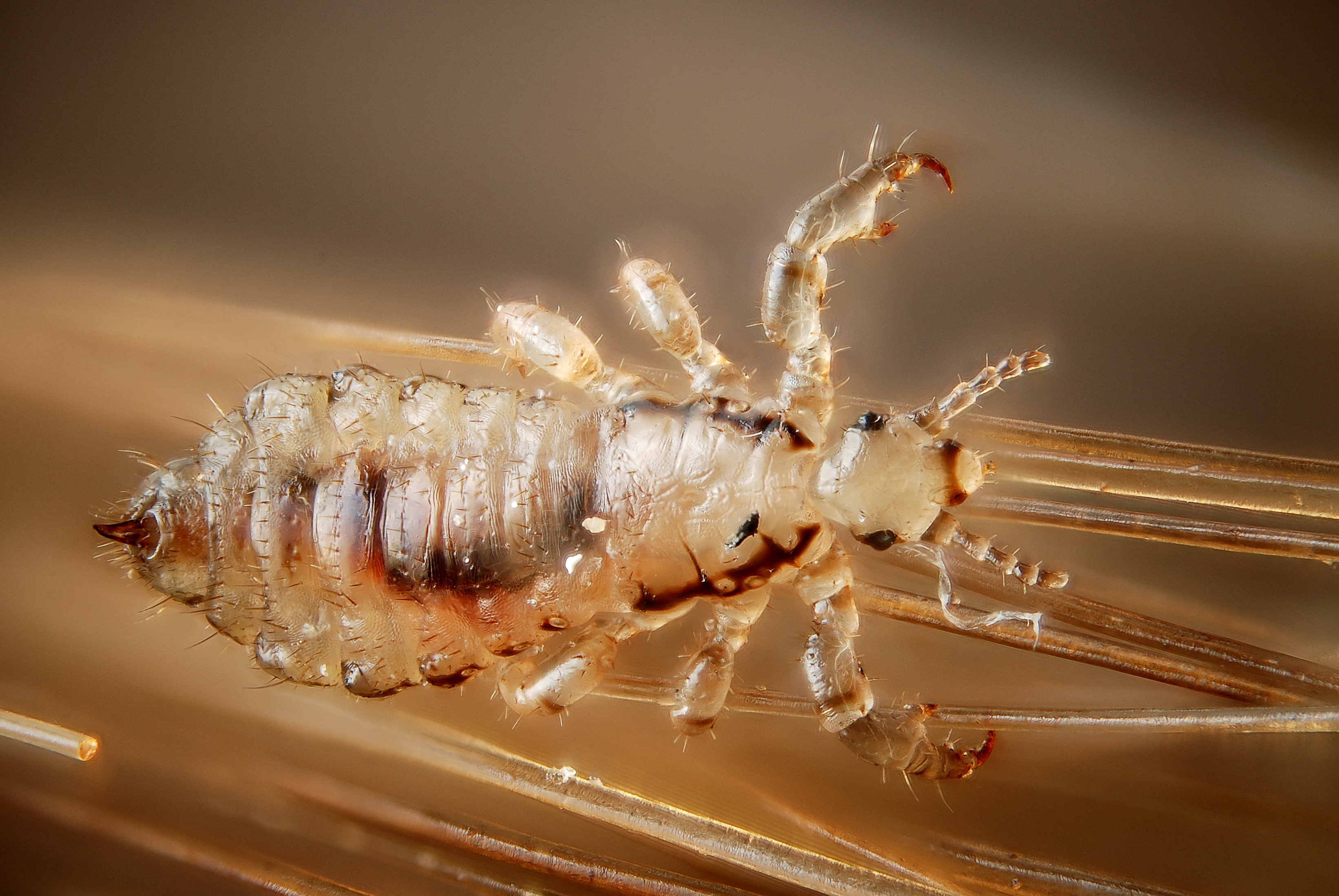 Male human head louse (4900867458)