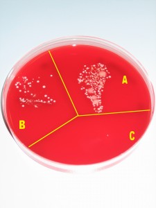 Microbial growth on a blood agar plate without any procedure (sector A), after washing hands (sector B), and after desinfecting hands with alcohol (sector C).