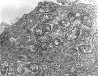 Transwiki approved by: w:en:User:Dmcdevit
This image was copied from wikipedia:en. The original description was:
A transmission electron micrograph (TEM) depicting a peritoneal mesothelial cell of a mouse that had been experimentally infected intraperitoneally with w:en:Orientia tsutsugamushi rickettsial micro-organisms. In this photomicrograph there were several organisms visible free within the mesothelial cell's cytoplasm. O. tsutsugamushi is the cause of w:en:scrub typhus.