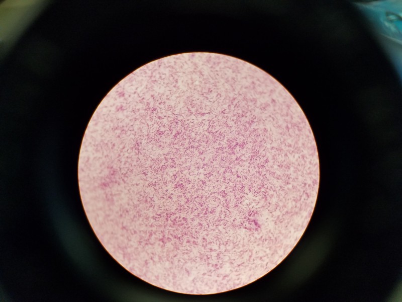 Microbiology gram stain