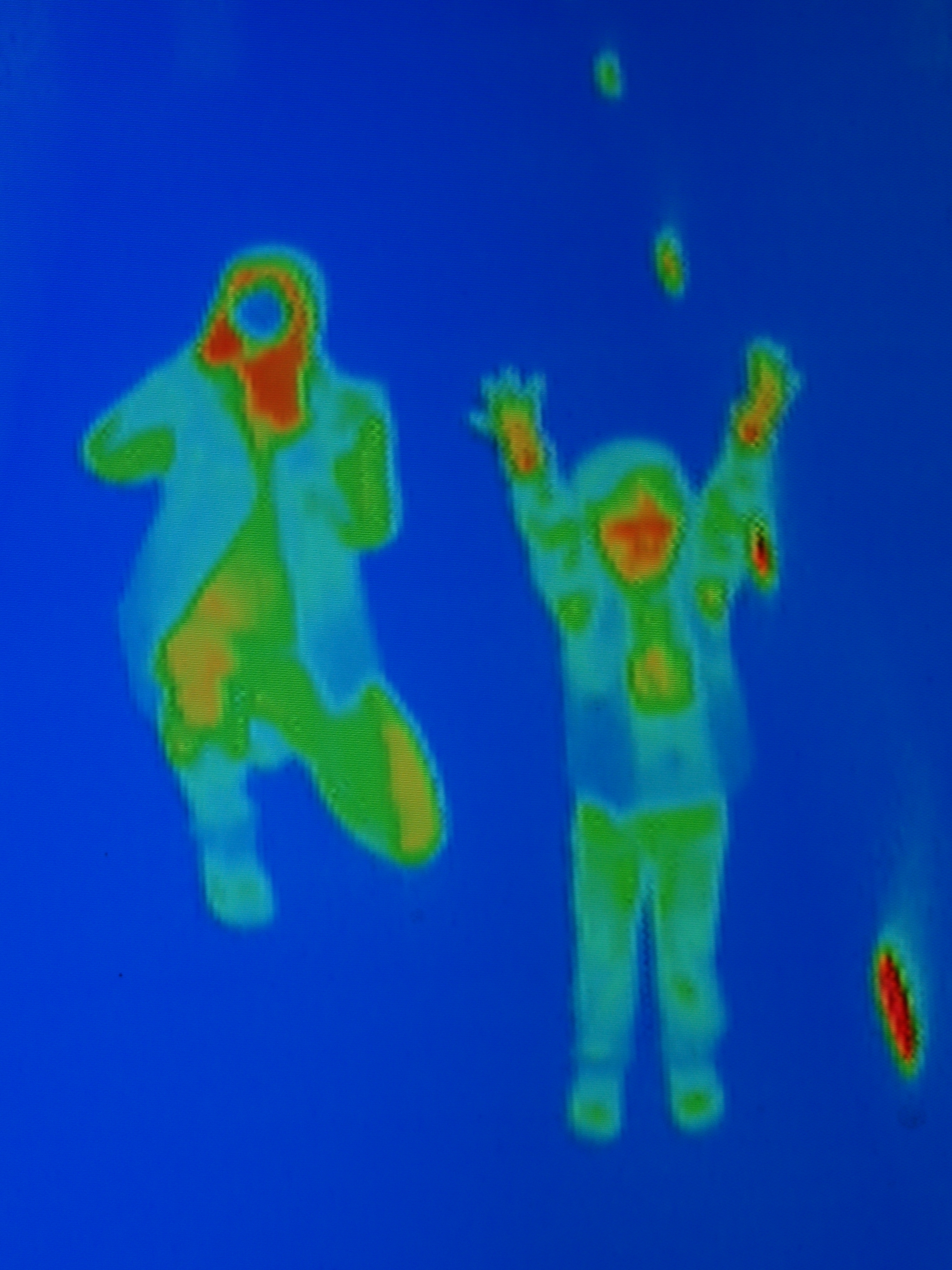 Thermografie Menschen 2