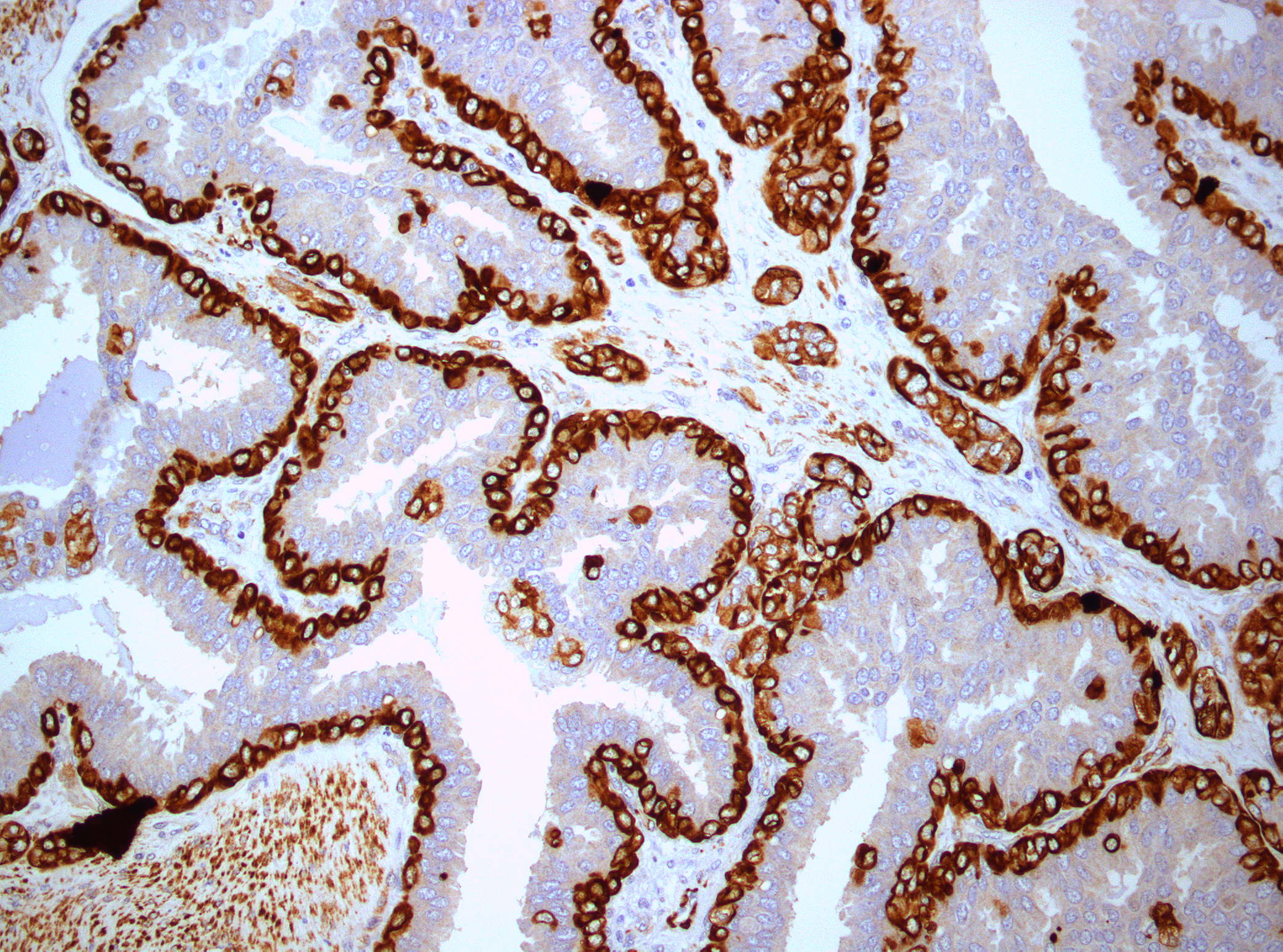 Immunohistochemistry of the breast