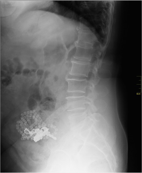 Medical X-Ray imaging XHM07 nevit