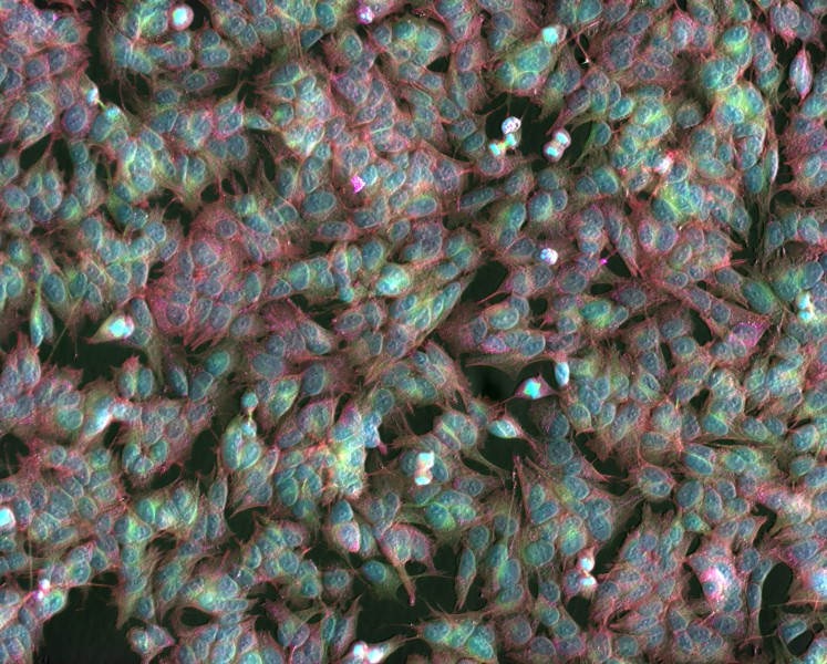 SH-SY5Y cells cultured on a 384 microwell plate, imaged with ZEISS Celldiscoverer 7 (30614937472)
