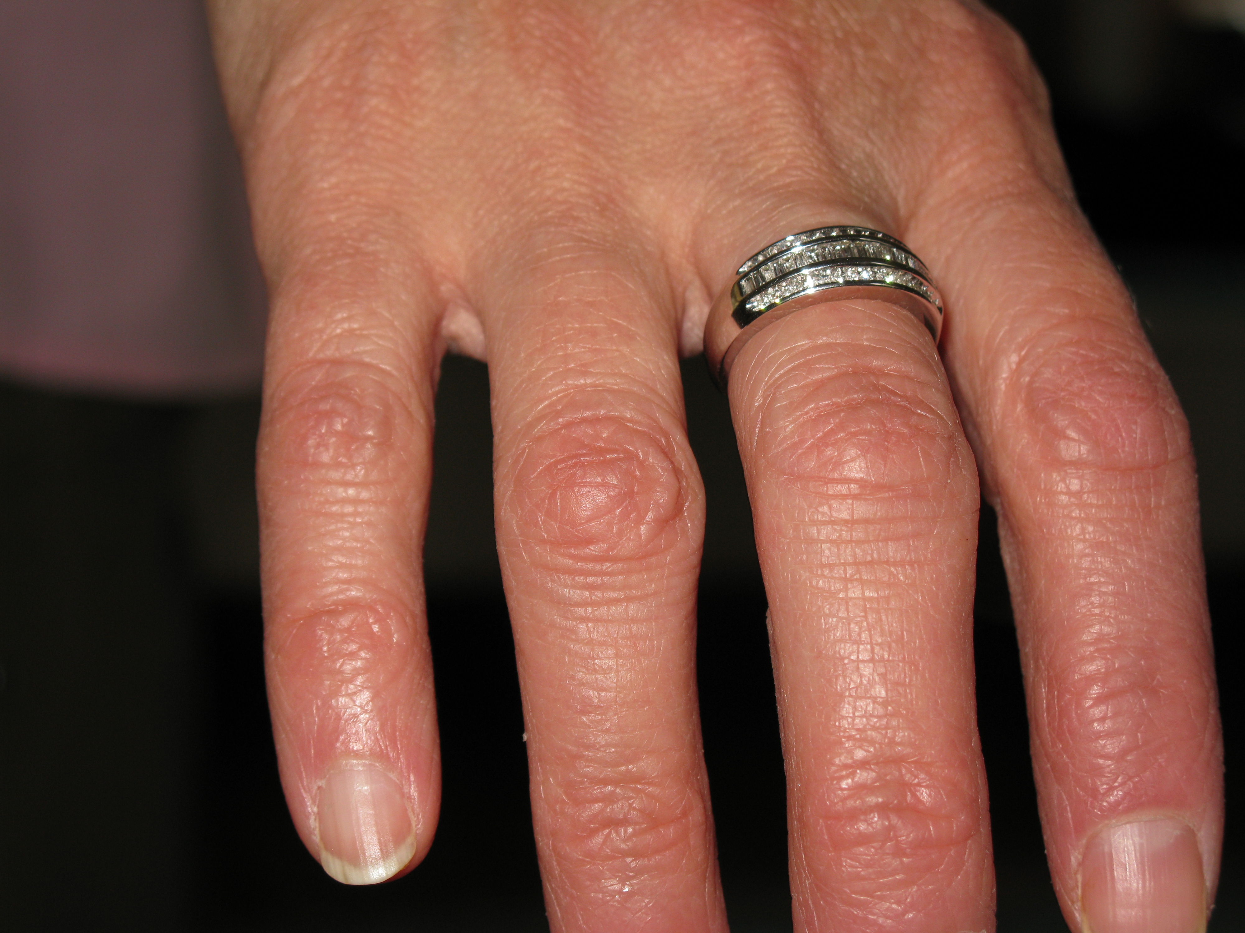 Anniversary ring