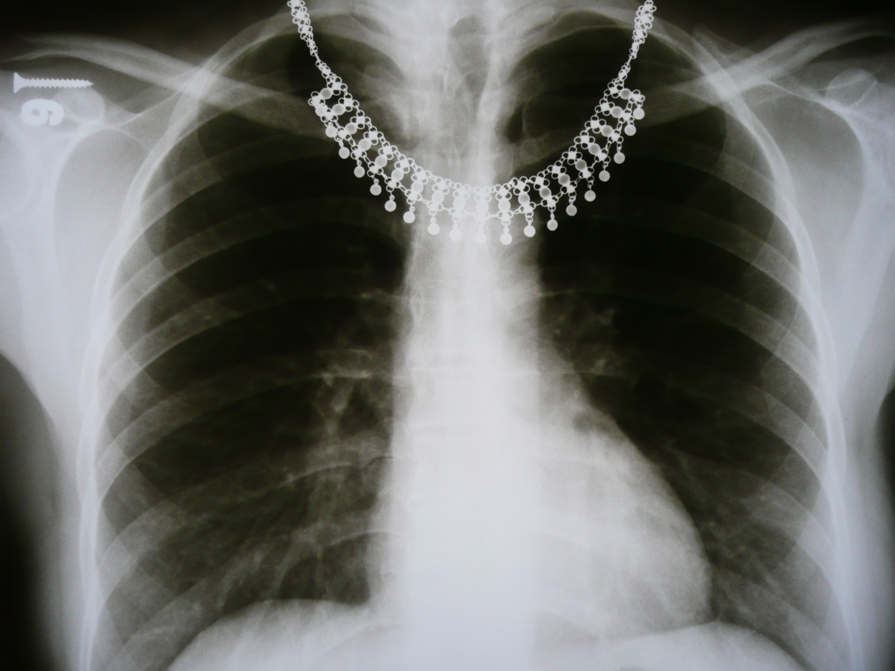 Radiology 1300311