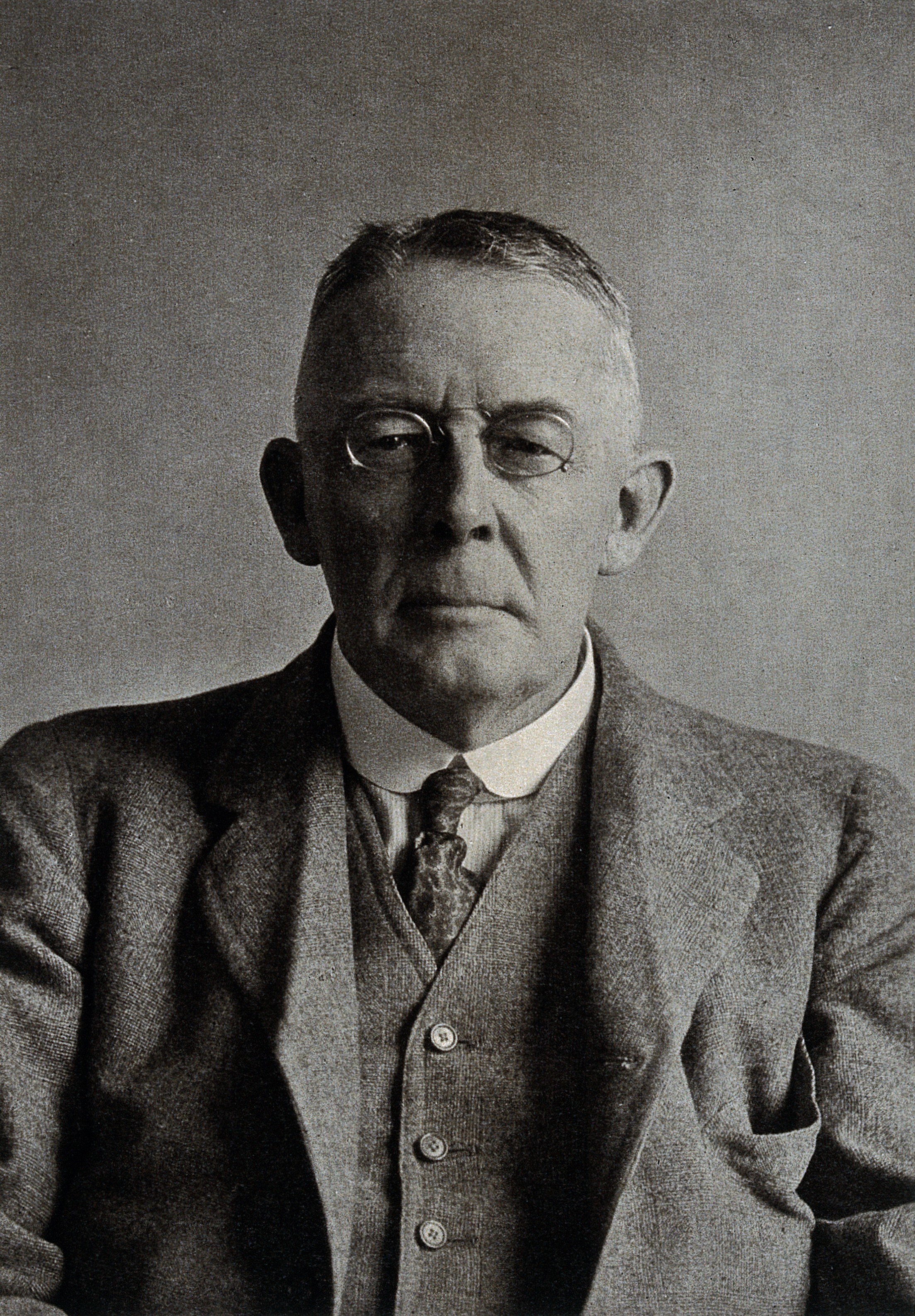 Archibald Campbell Stevenson. Photograph. Wellcome V0027843