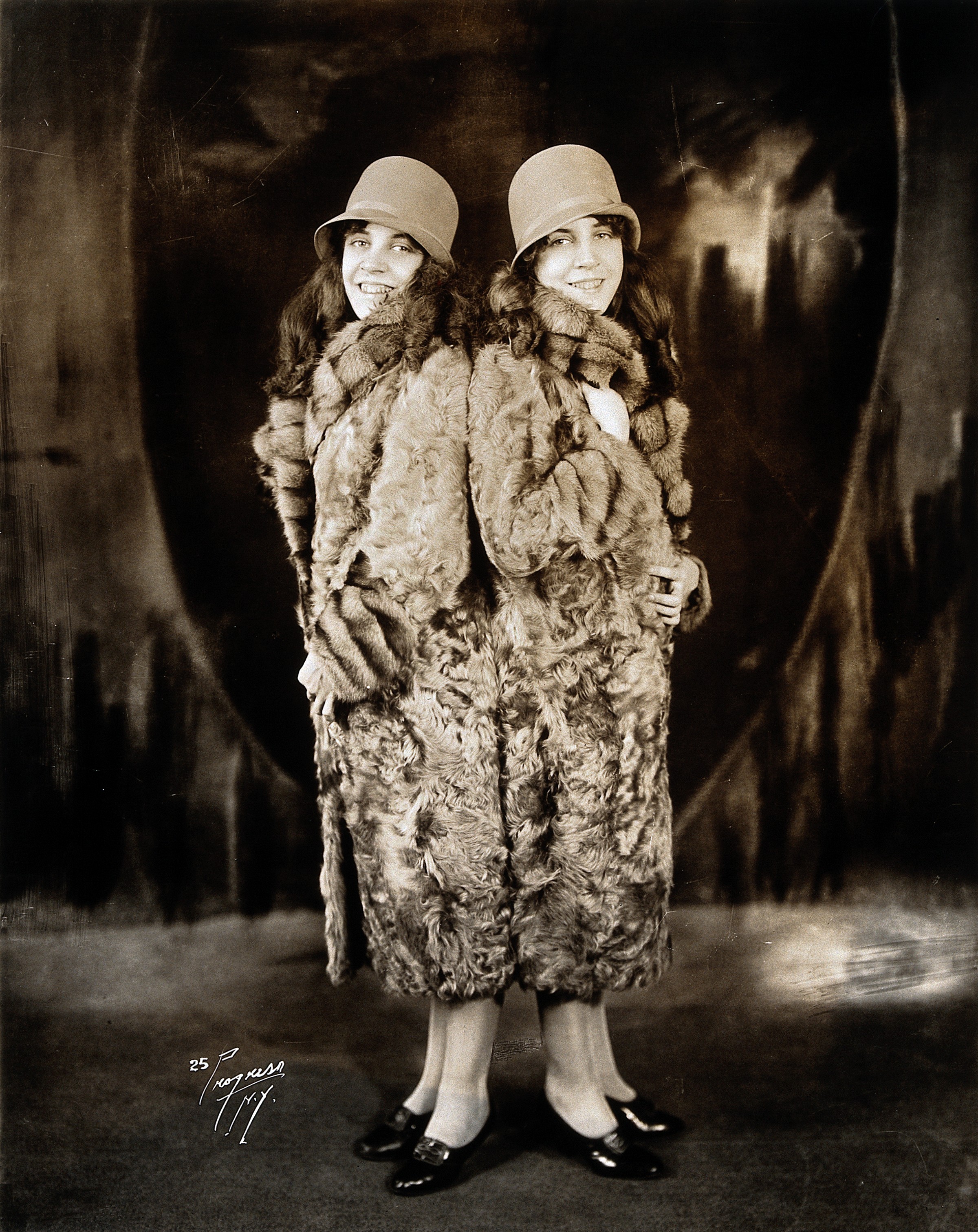 Daisy and Violet Hilton, conjoined twins, wearing fur coats. Wellcome V0029589