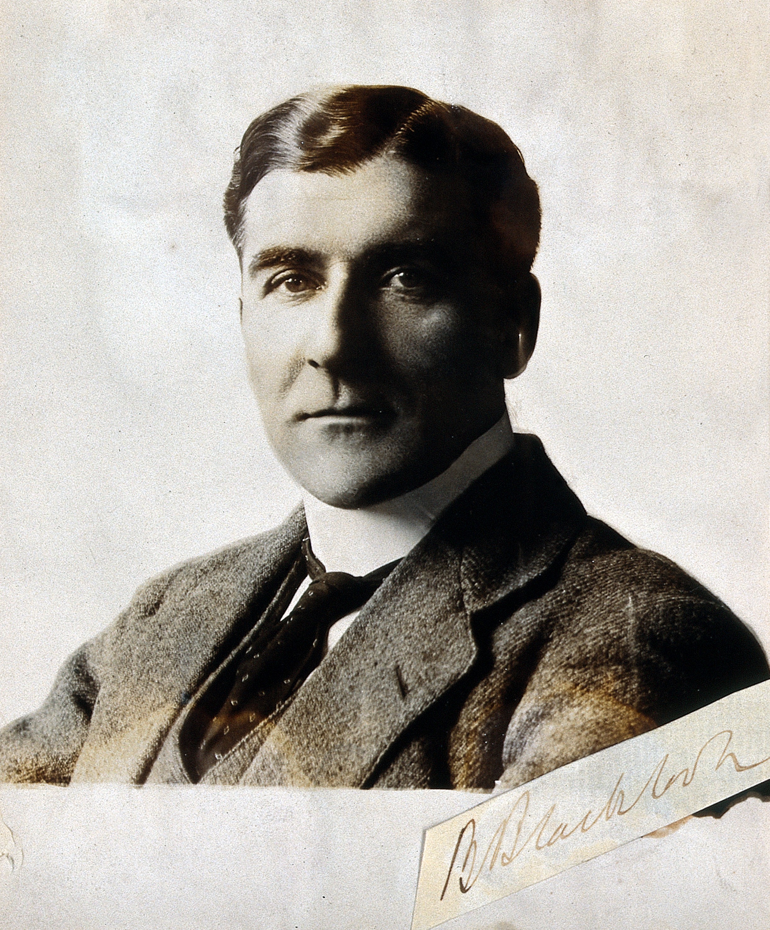 Donald Breadalbane Blacklock. Photograph. Wellcome V0027716
