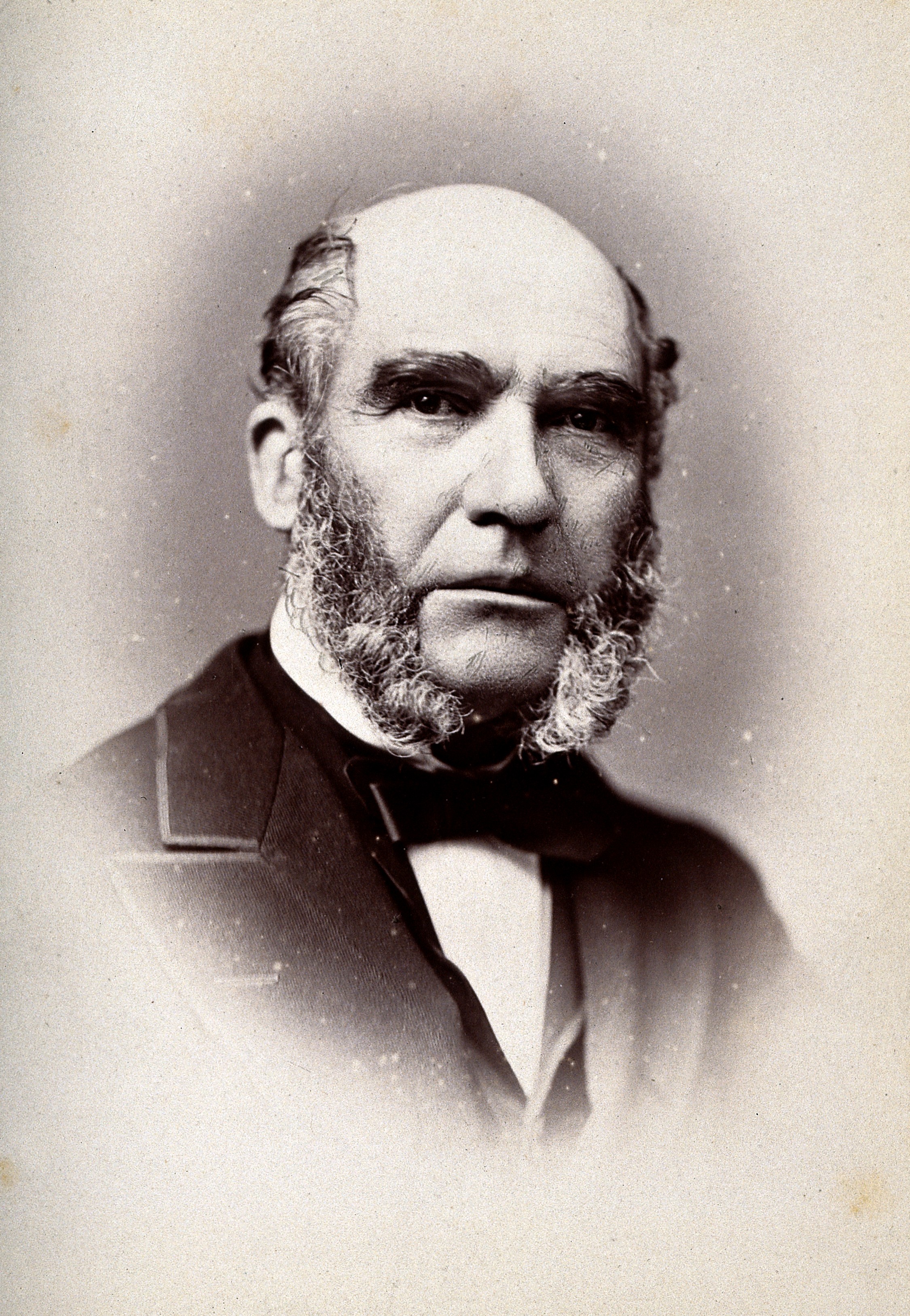 George Critchett. Photograph by G. Jerrard, 1881. Wellcome V0026222