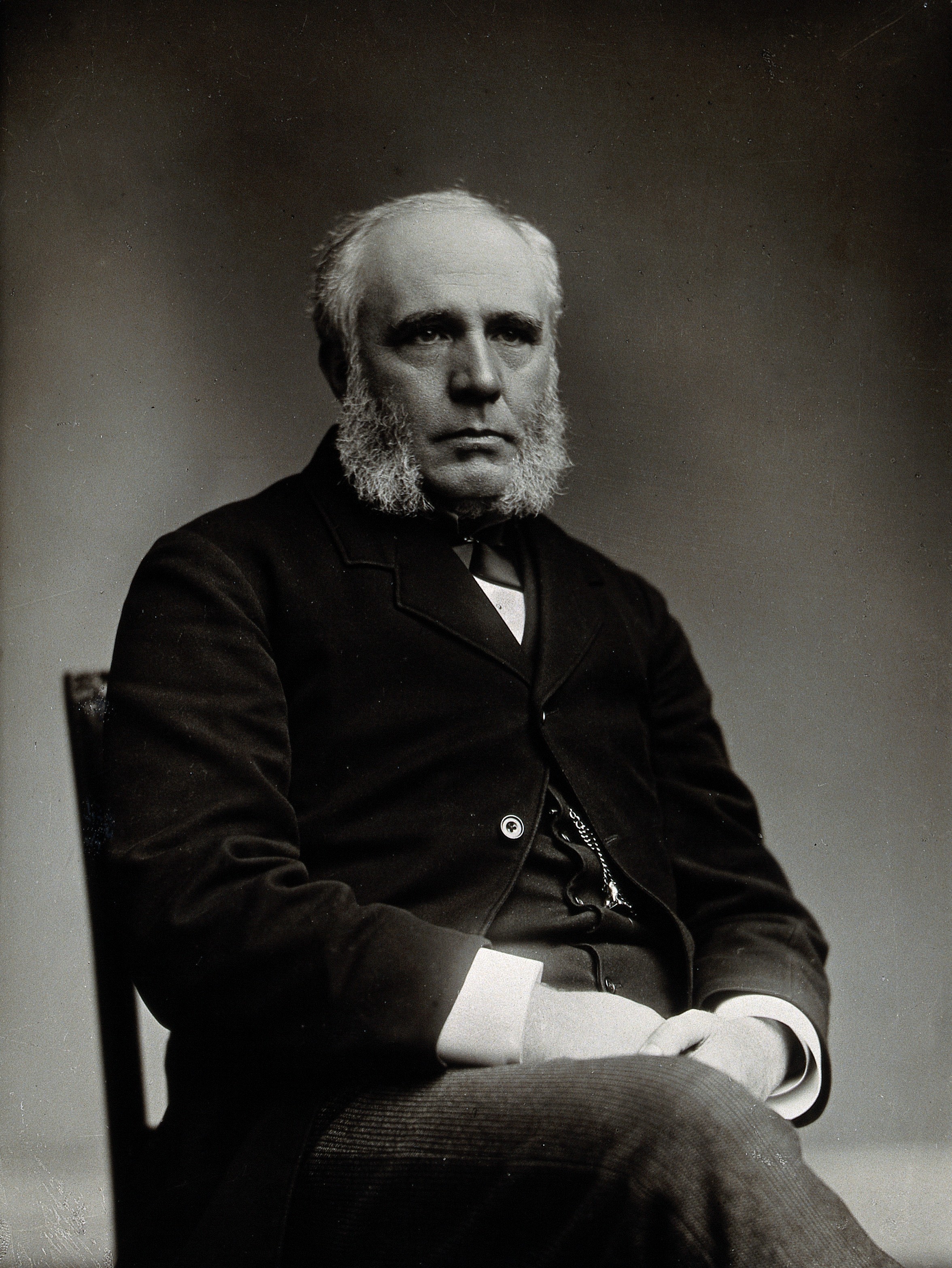 James Finlayson. Photograph. Wellcome V0028701