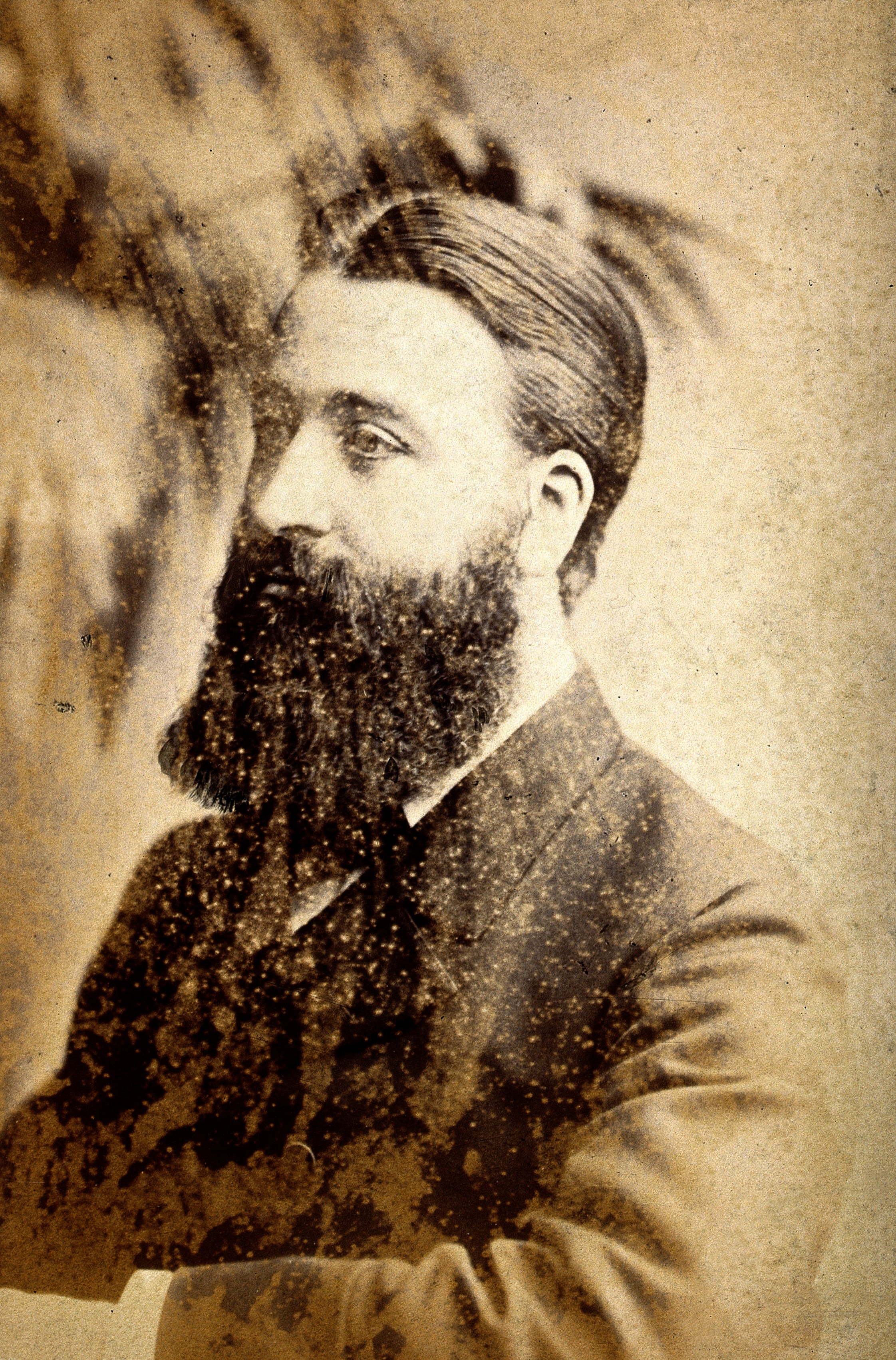 James Shuter. Photograph by Adèle. Wellcome V0027160