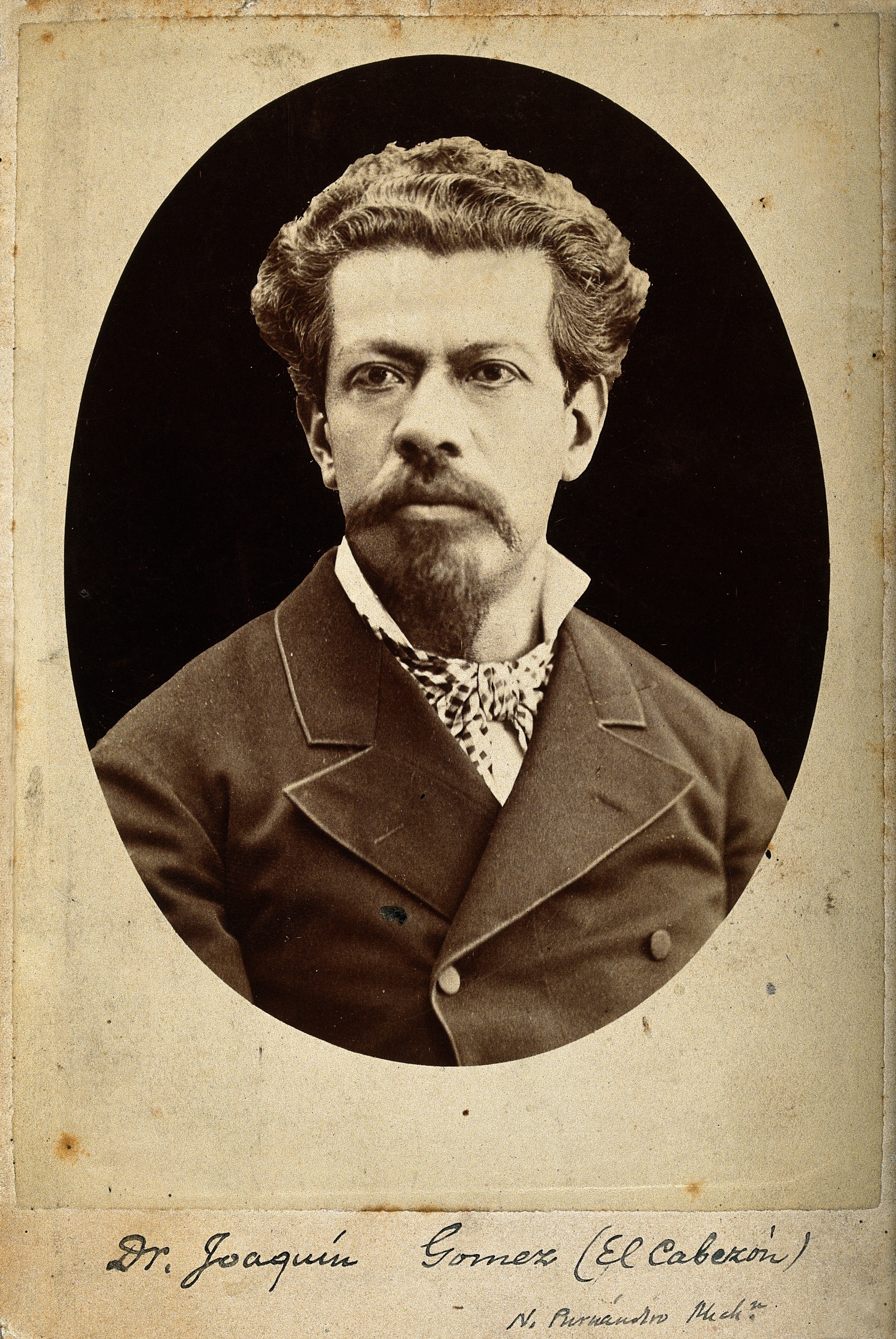 Joaquin Gomez. Photograph. Wellcome V0028248