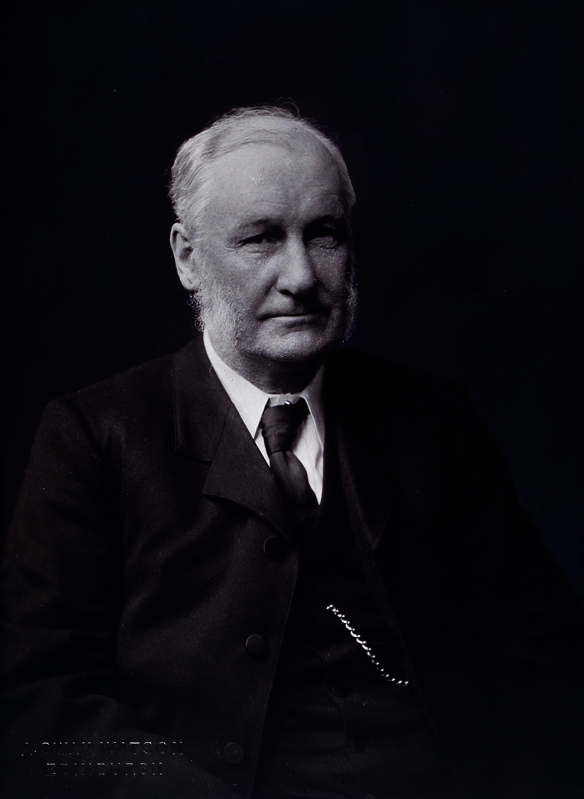 John Chiene. Photograph by A. Swan Watson. Wellcome V0026187