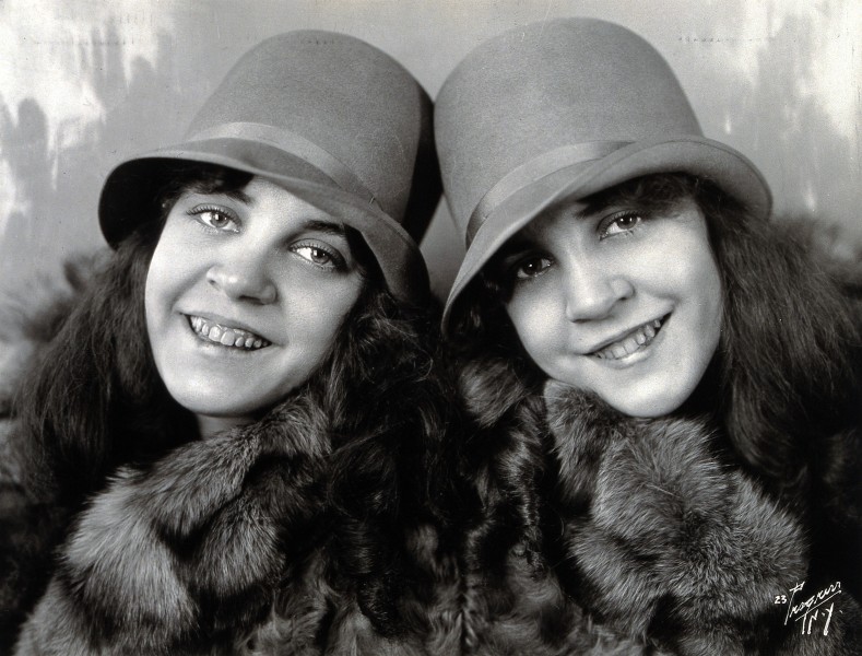 Daisy and Violet Hilton, conjoined twins, head and shoulders Wellcome V0029595