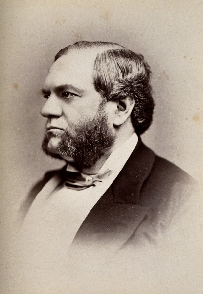 James Matthews Duncan. Photograph by G. Jerrard, 1881. Wellcome V0026317