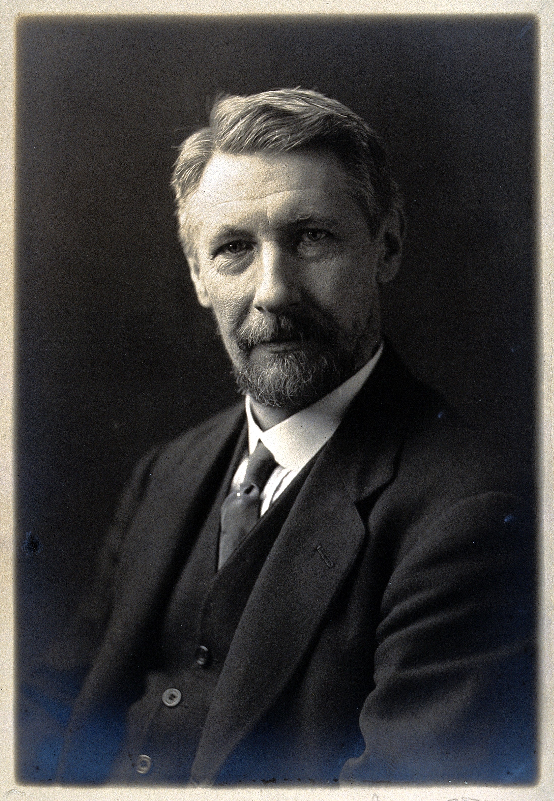 R. Wallace-Henry. Photograph. Wellcome V0027308