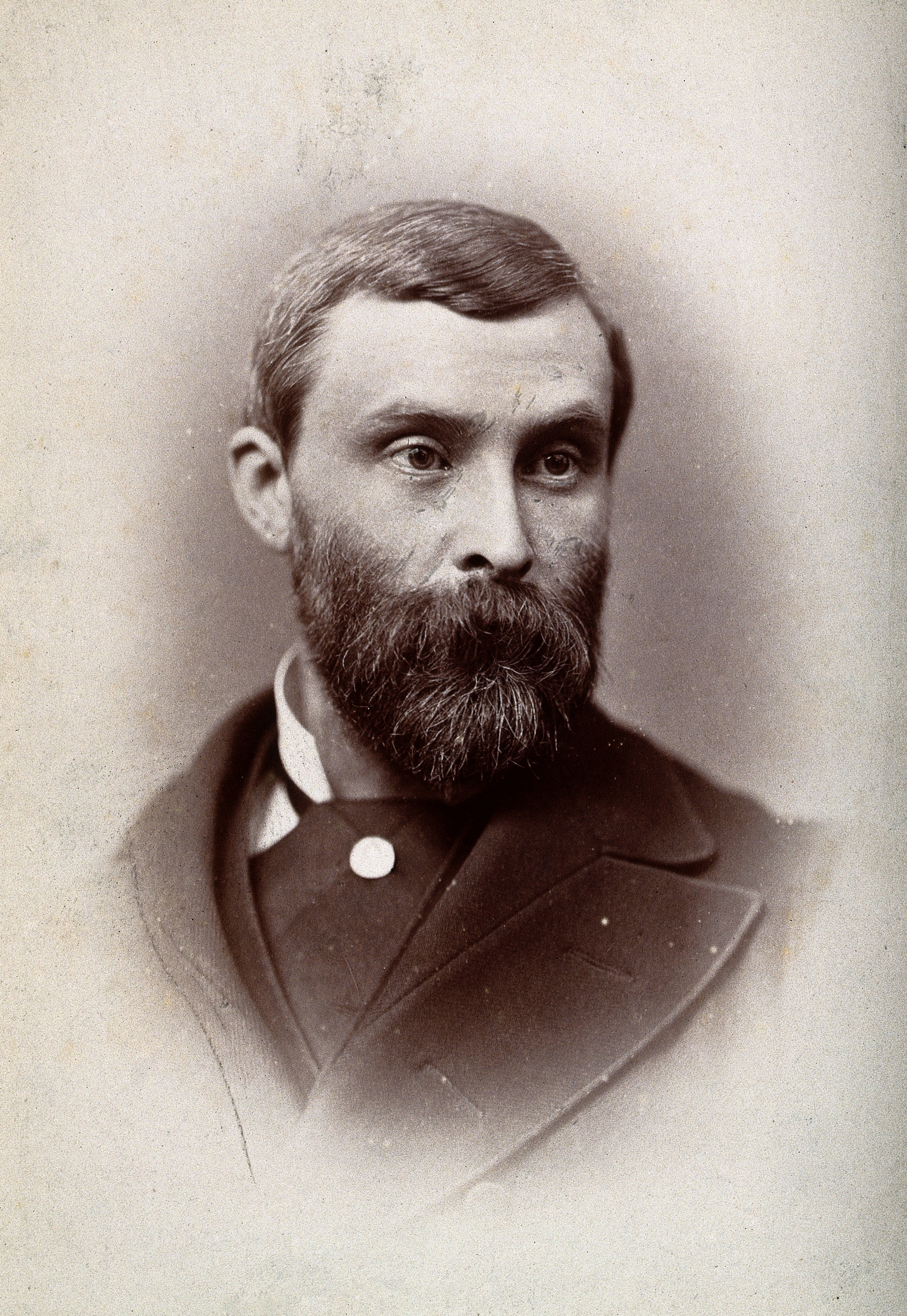 Sir Thomas Lauder Brunton. Photograph by G. Jerrard, 1881. Wellcome V0026106