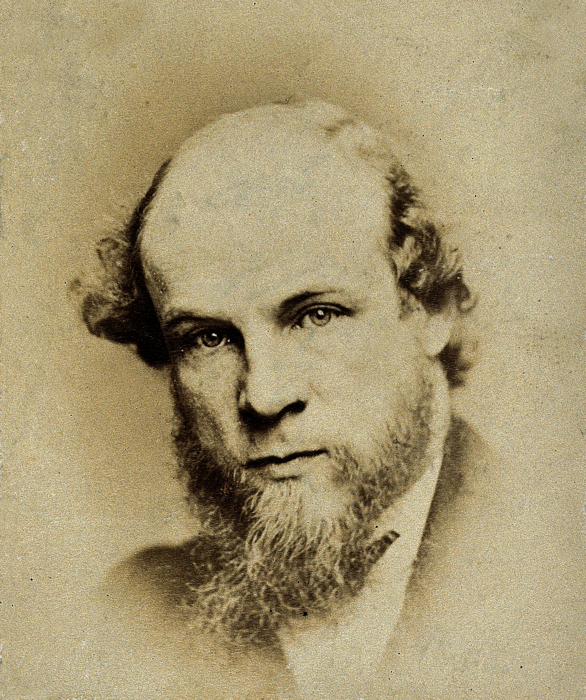 Sir William Turner. Photograph. Wellcome V0027278
