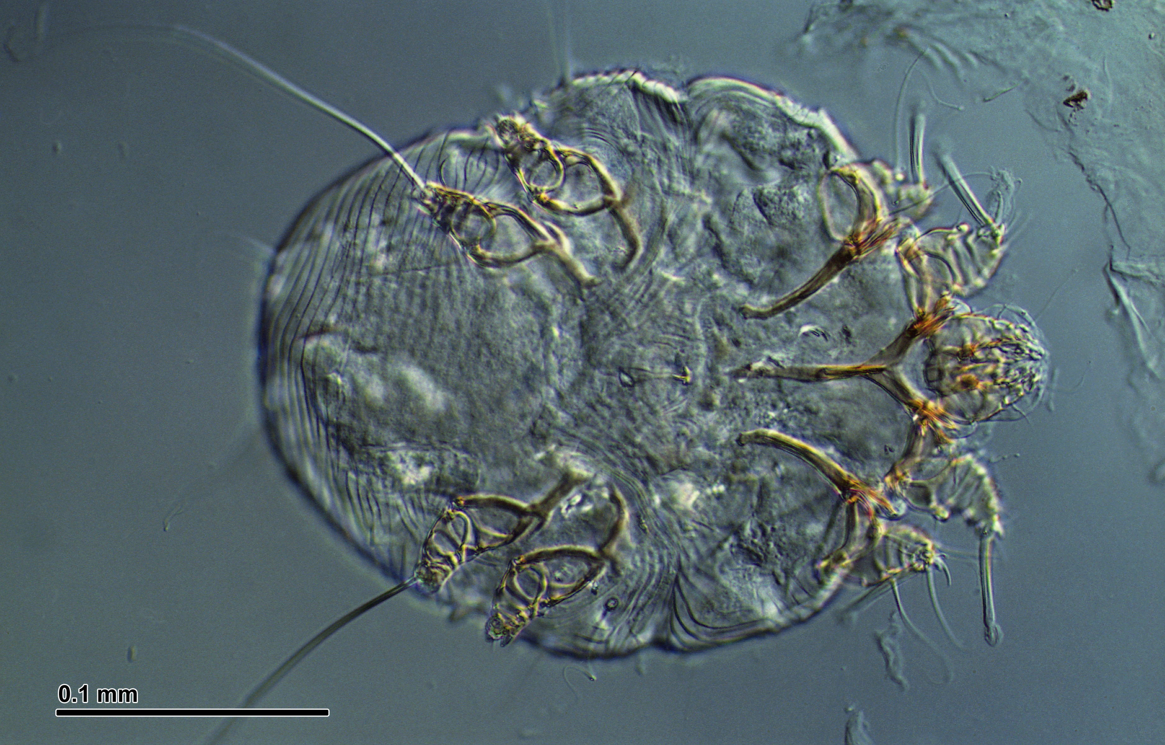 Itch mite (247 32A)