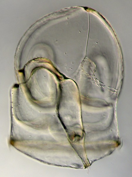 Tornaria larva
