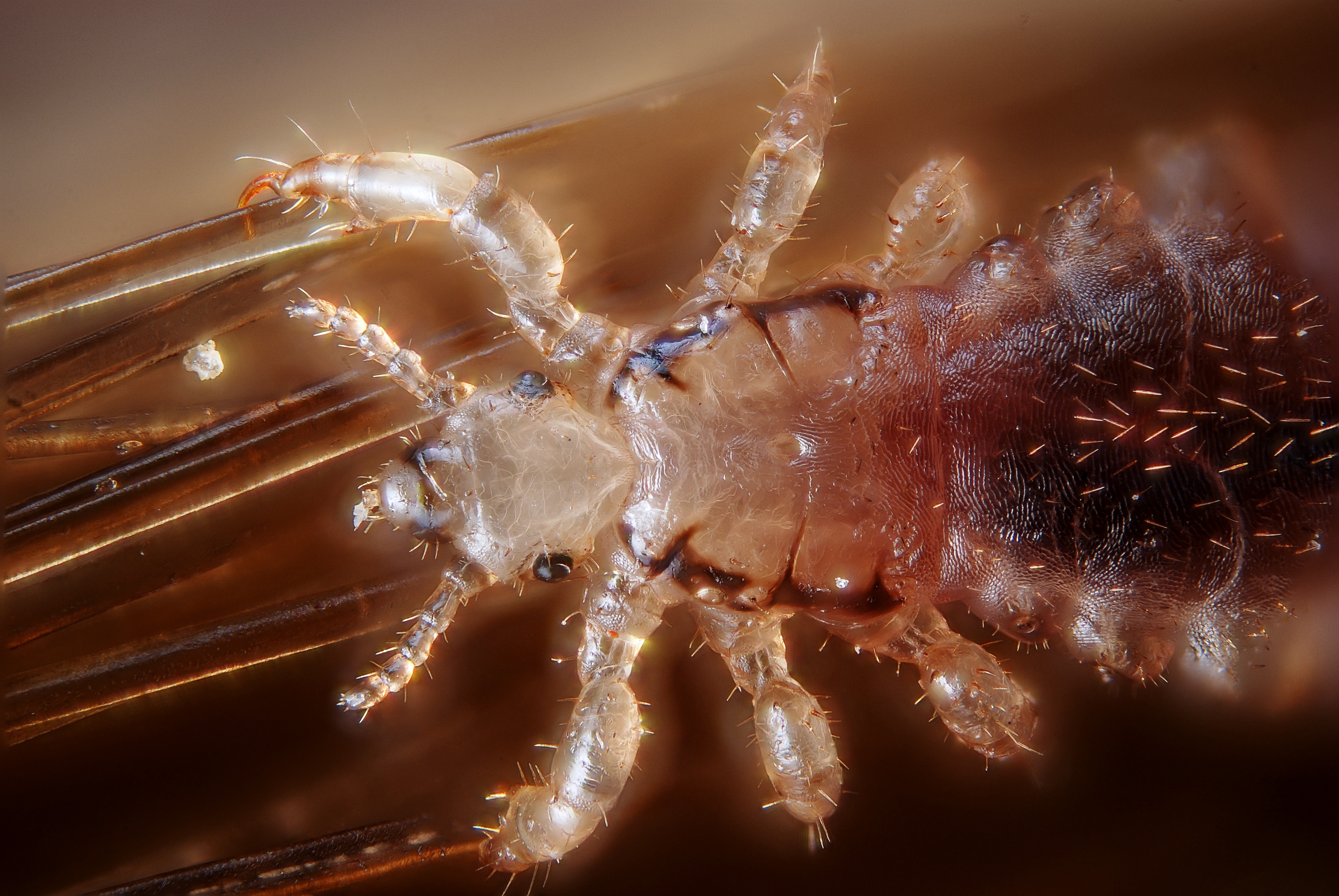 Female human head louse (4900866320)