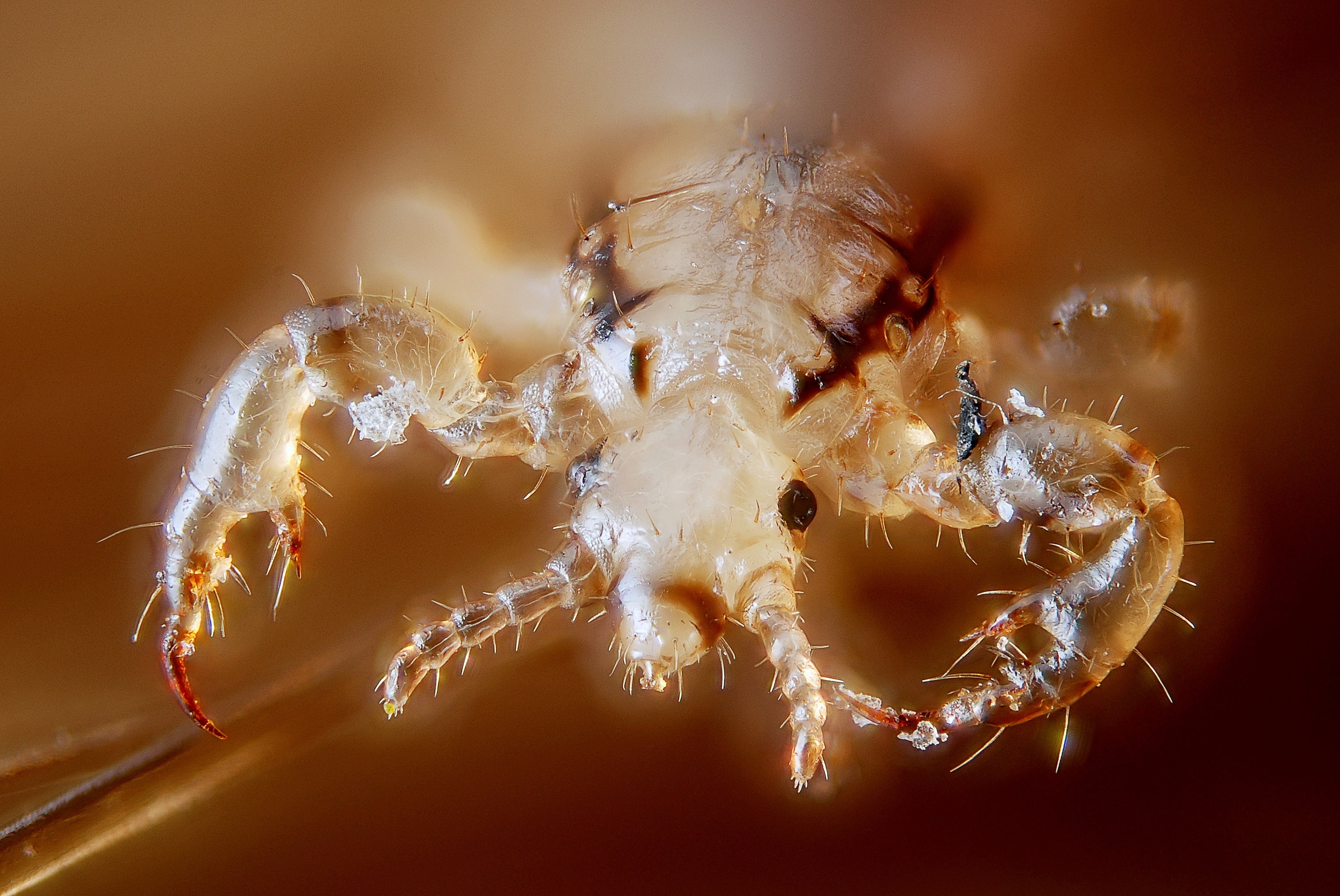 Male human head louse (4900867210)