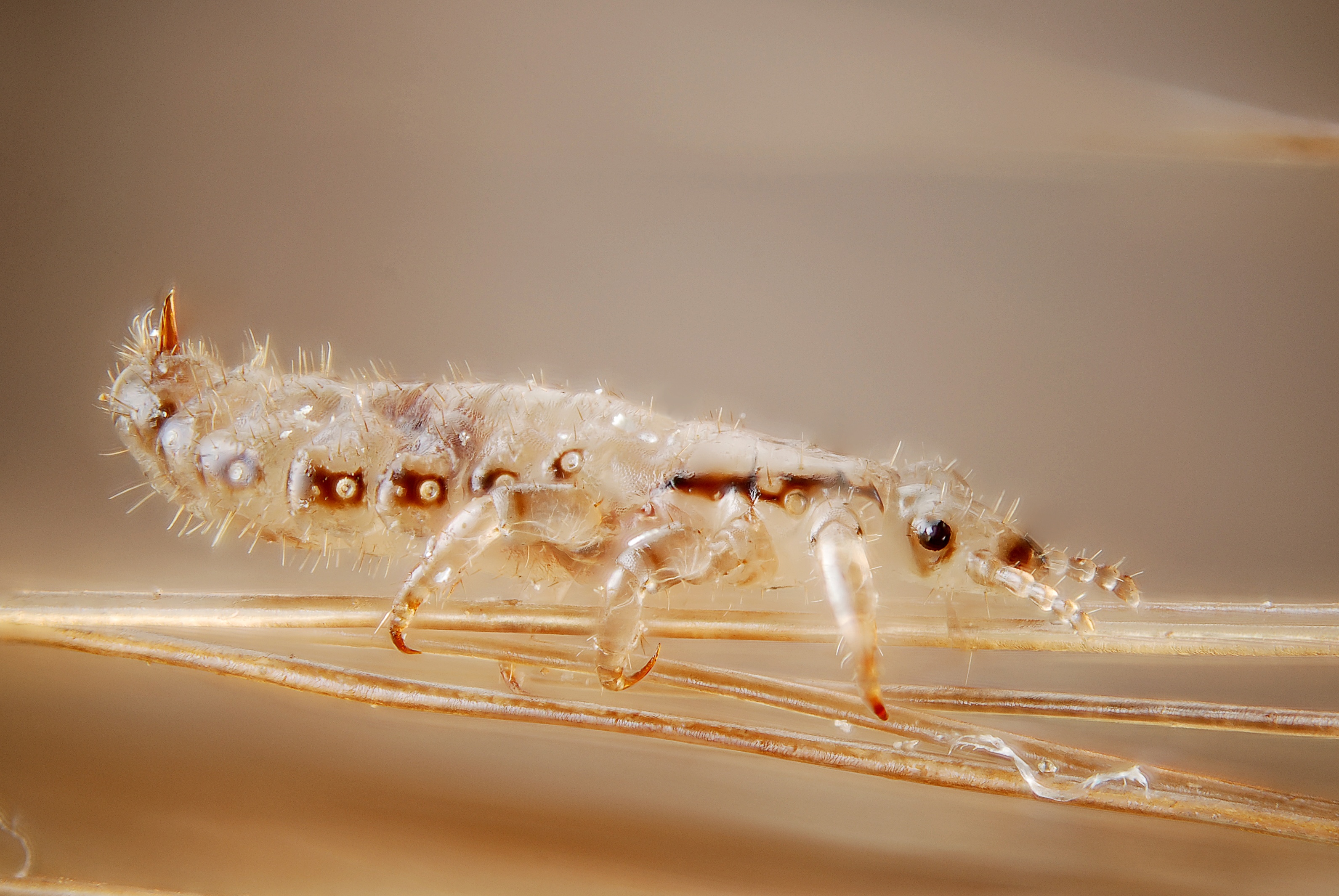 Male human head louse (4900867726)