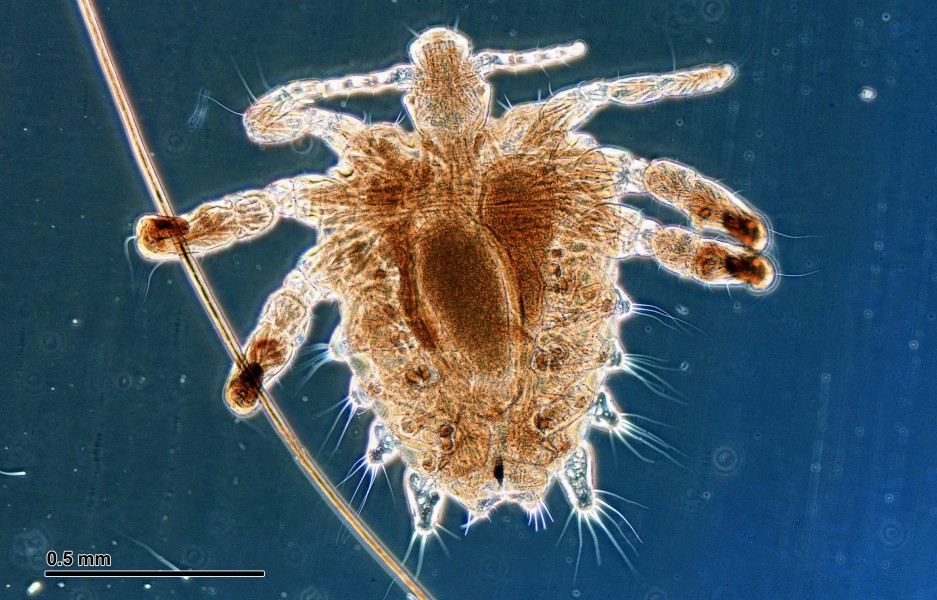 Crab louse (251 23) Female, from a human host