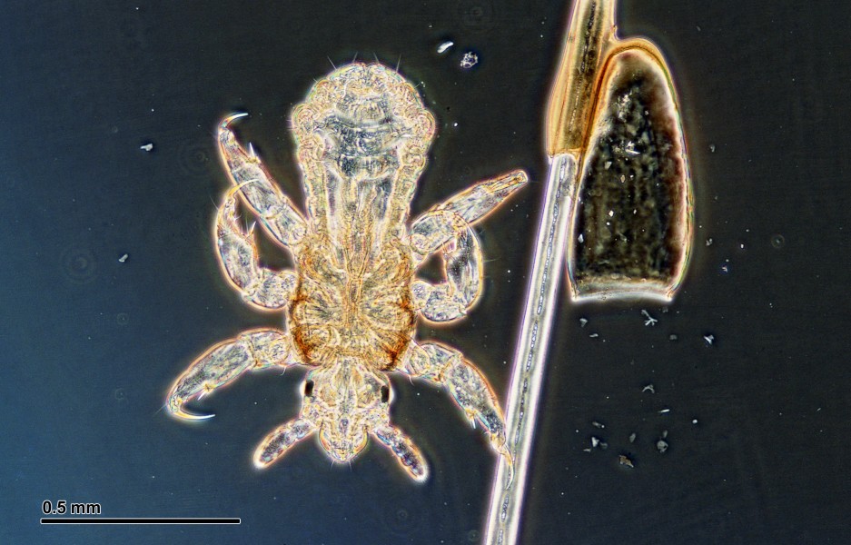 Crab louse (251 26) Larva and egg, from a human host