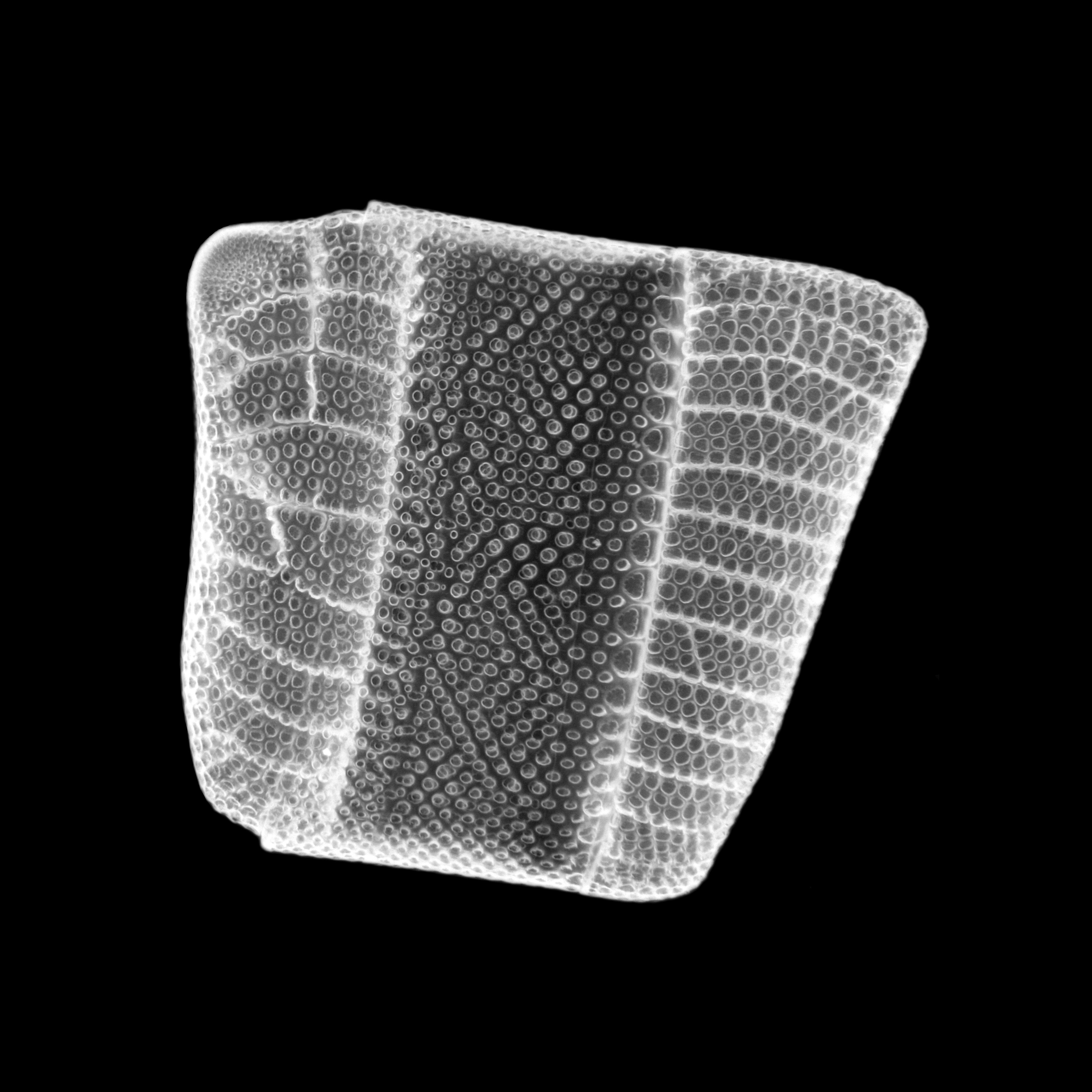 Diatom - Isthmia nervosa - 400x (16237138292)