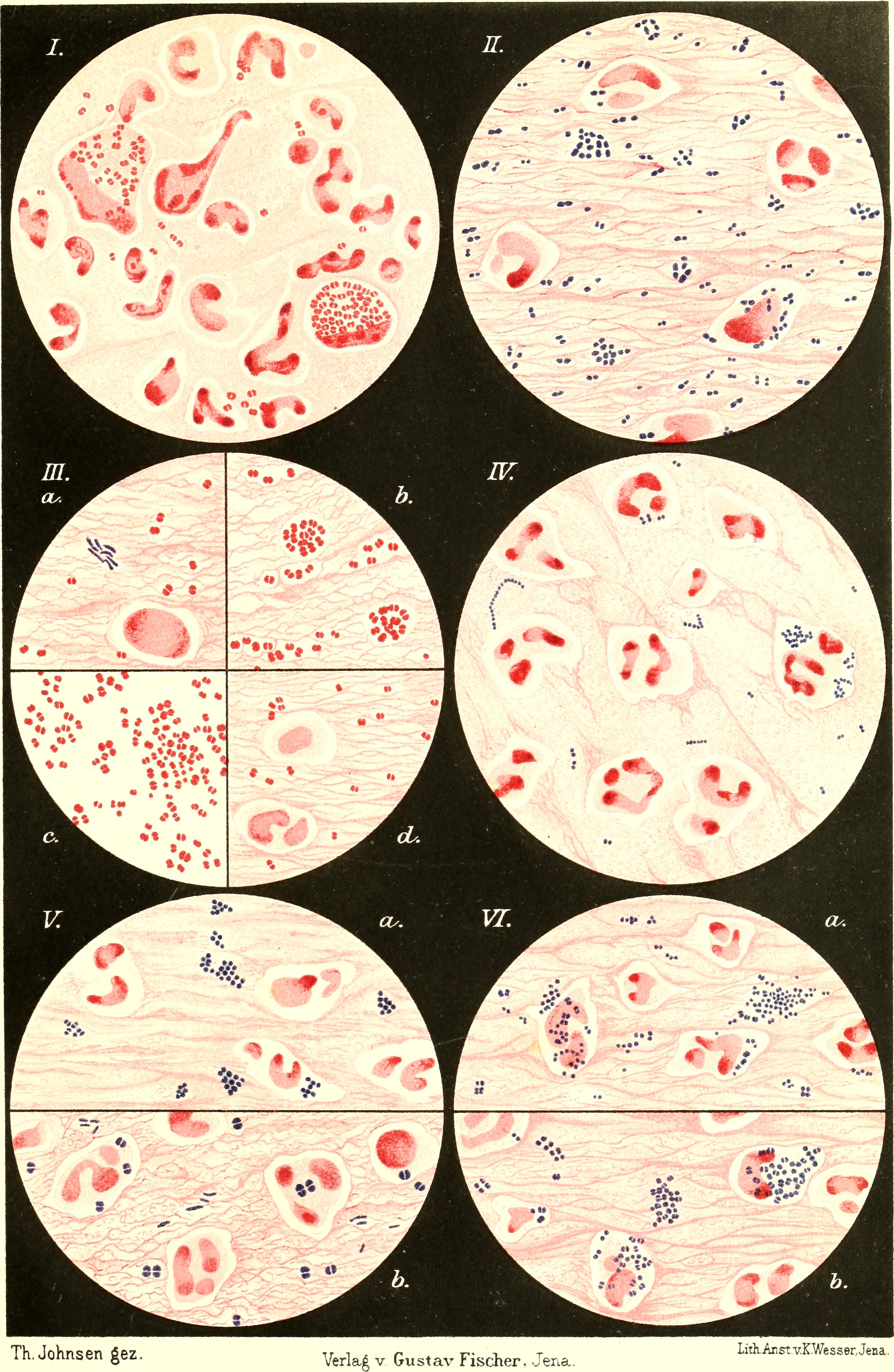 Die Bakteriologie in der Augenheilkunde (electronic resource) (1903) (20326489626)