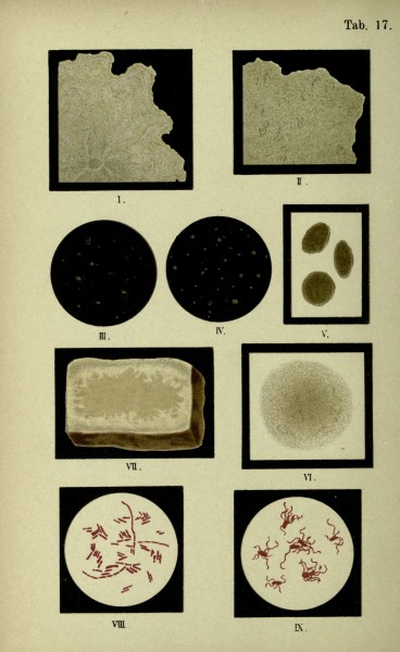 Atlas and essentials of bacteriology (Tab. 17) (6418455879)