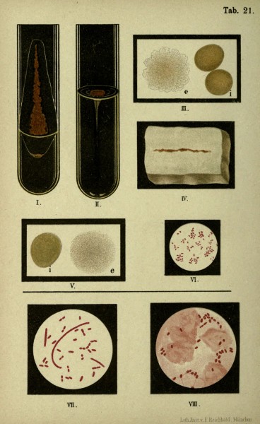 Atlas and essentials of bacteriology (Tab. 21) (6418458323)
