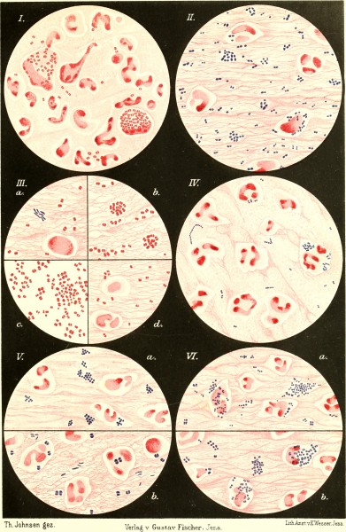 Die Bakteriologie in der Augenheilkunde (electronic resource) (1903) (20326489626)