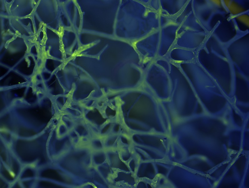 Porifera