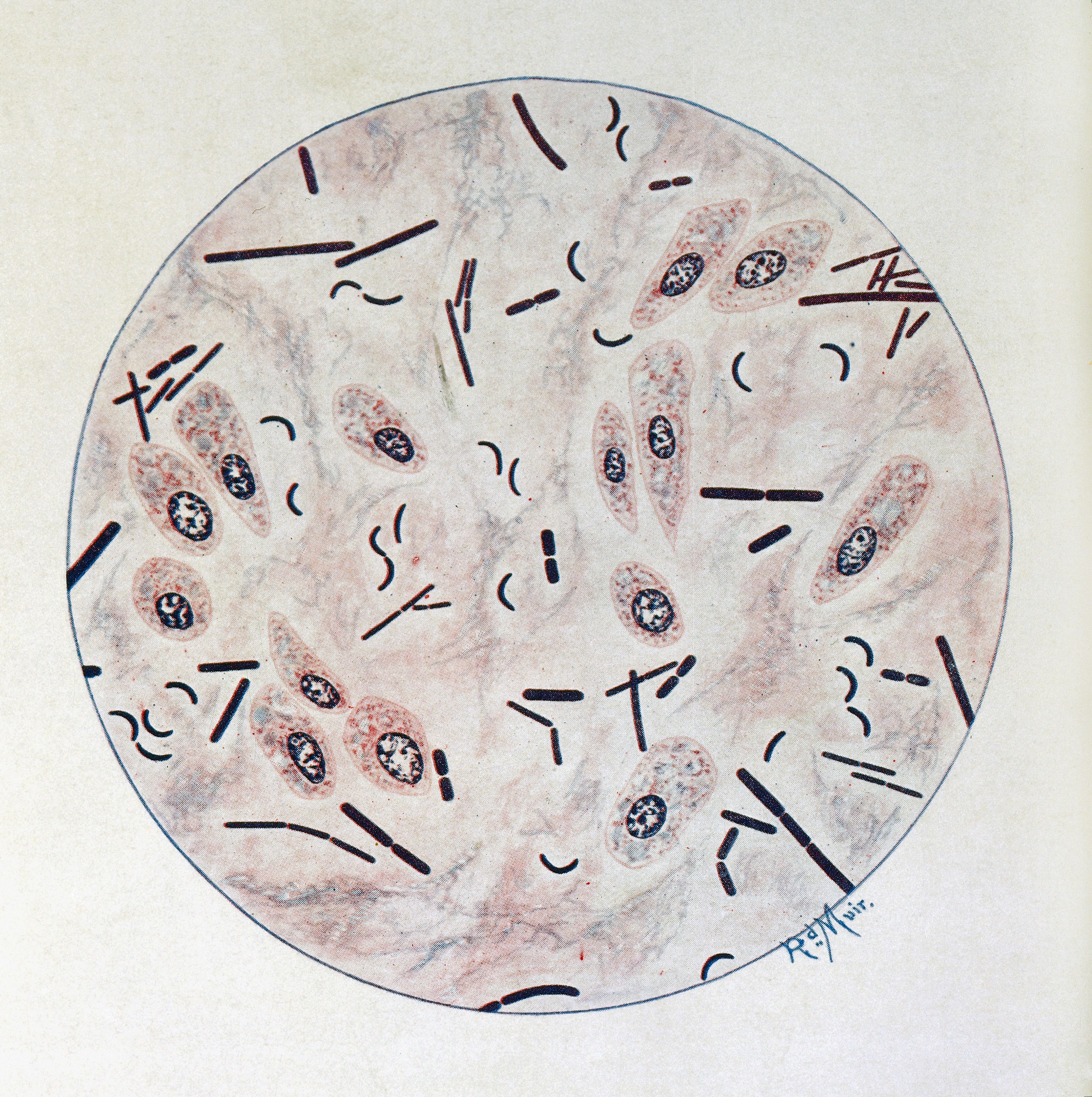 R. Muir, Bacteriological Atlas, 1927 Wellcome L0030997