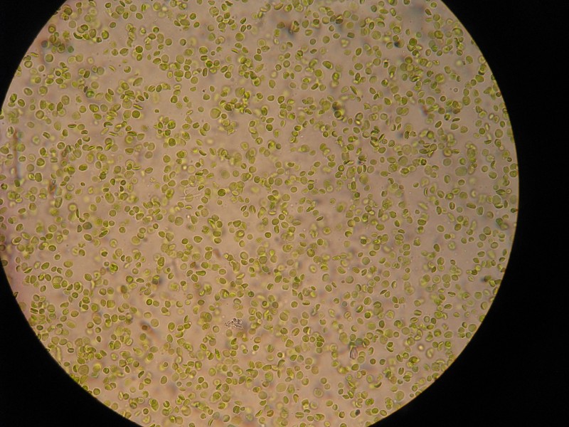 Kloroplastid