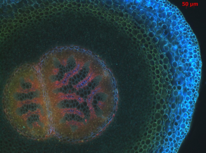 Lycopodium complanatum Plectostele