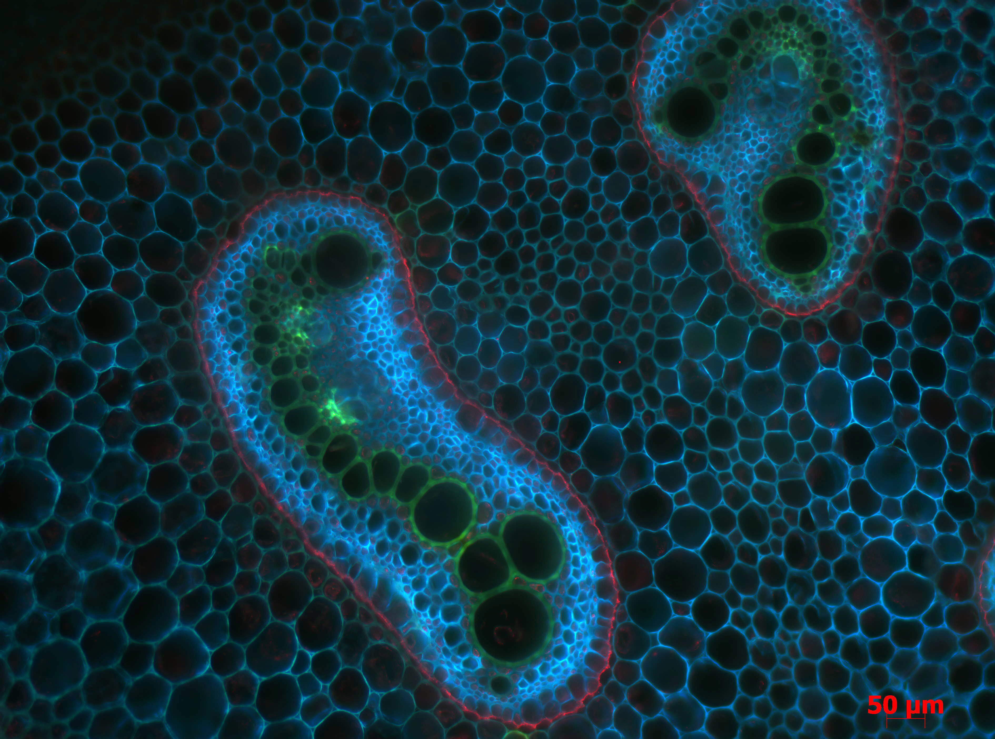 Pteridium aquilinum Dictyostele