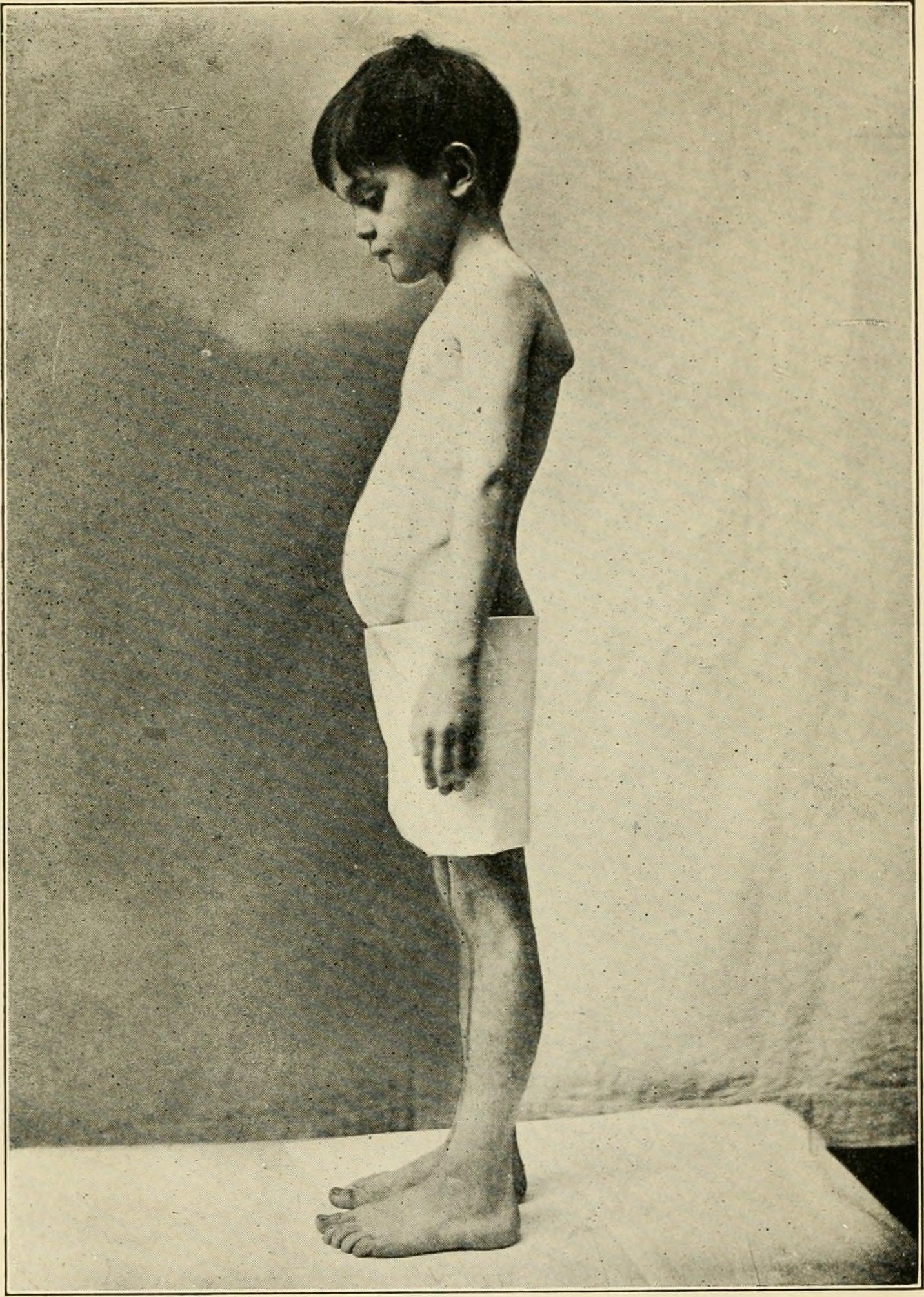 Nutrition and growth in children (1922) (14597632810)