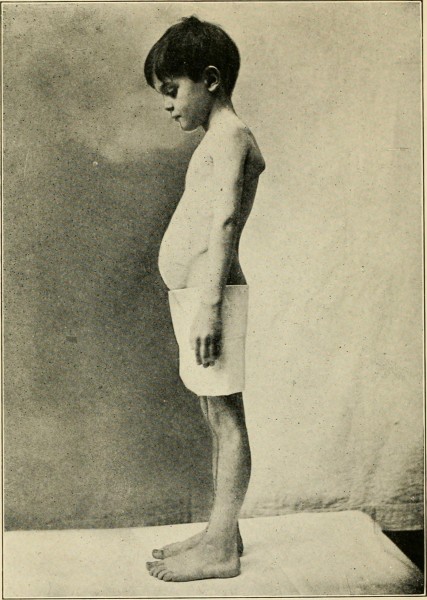 Nutrition and growth in children (1922) (14597632810)