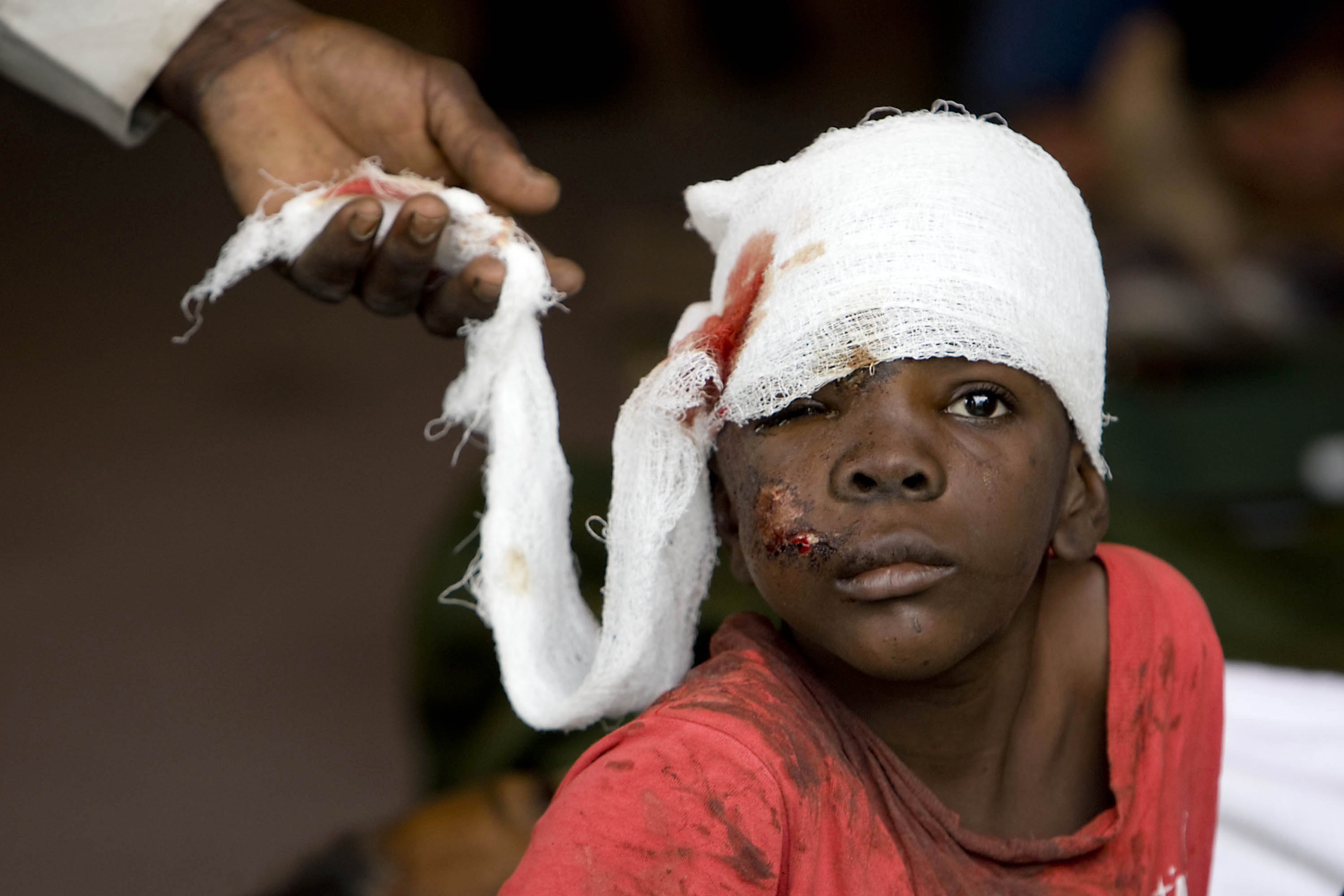 Boy receiving treatment after Haiti earthquake