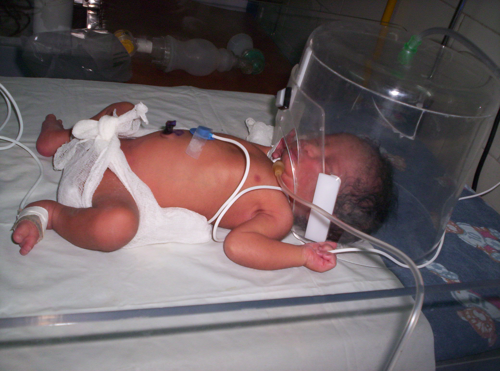 Little NICU patient