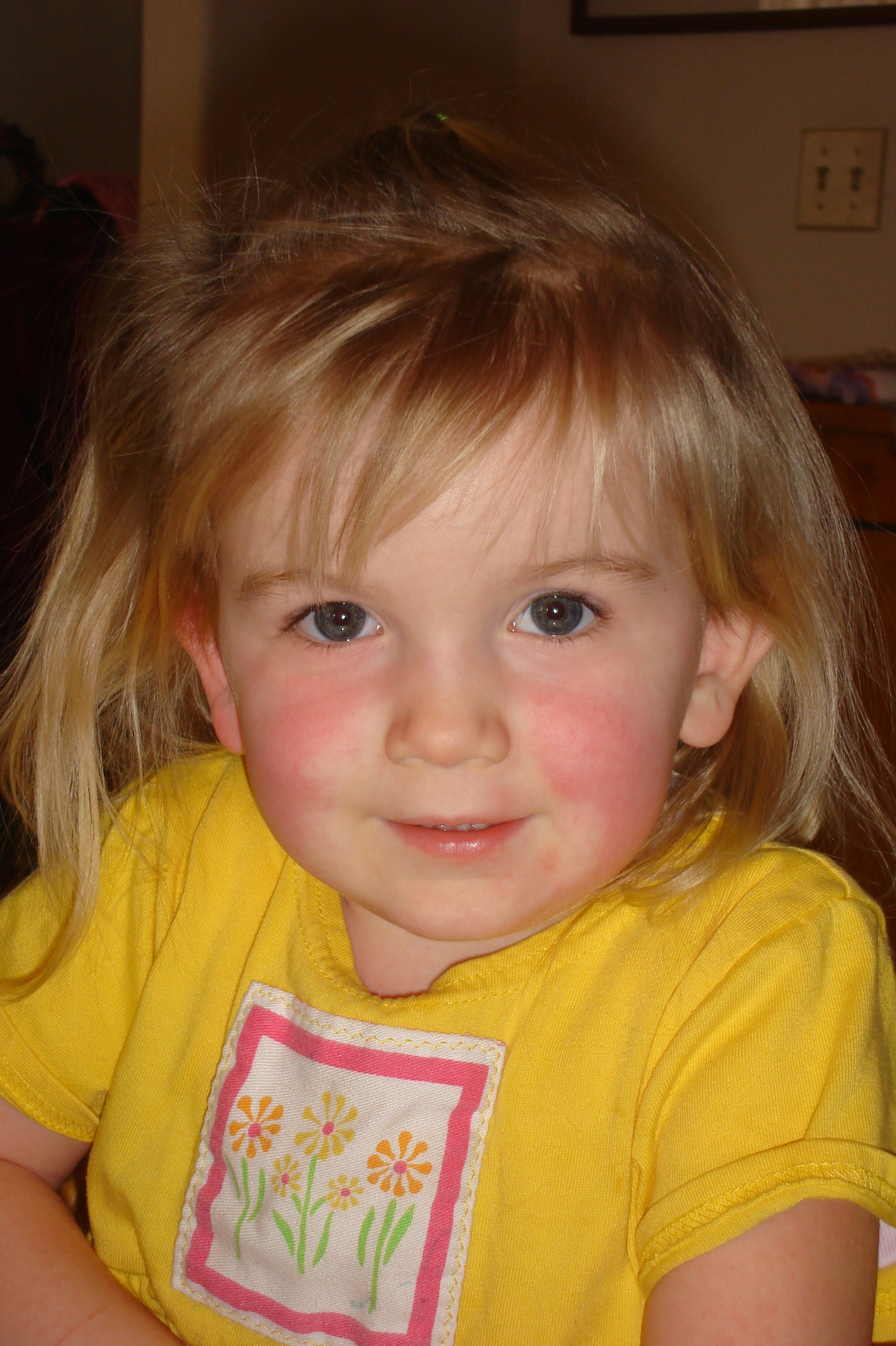 Scarlet fever 1