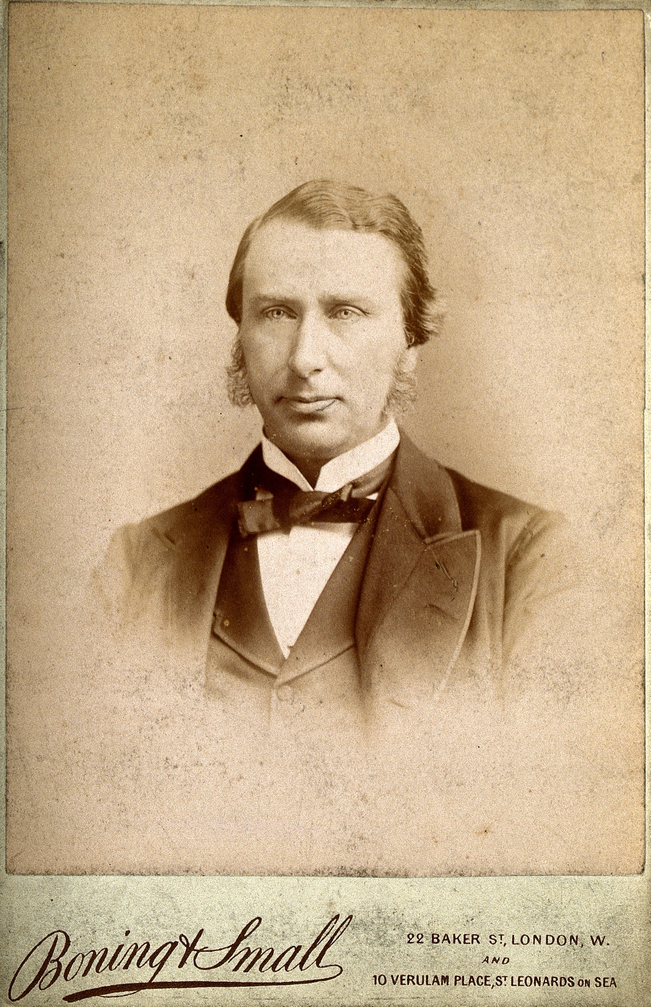 An unidentified man, possibly called Langton. Photograph by Wellcome V0027372